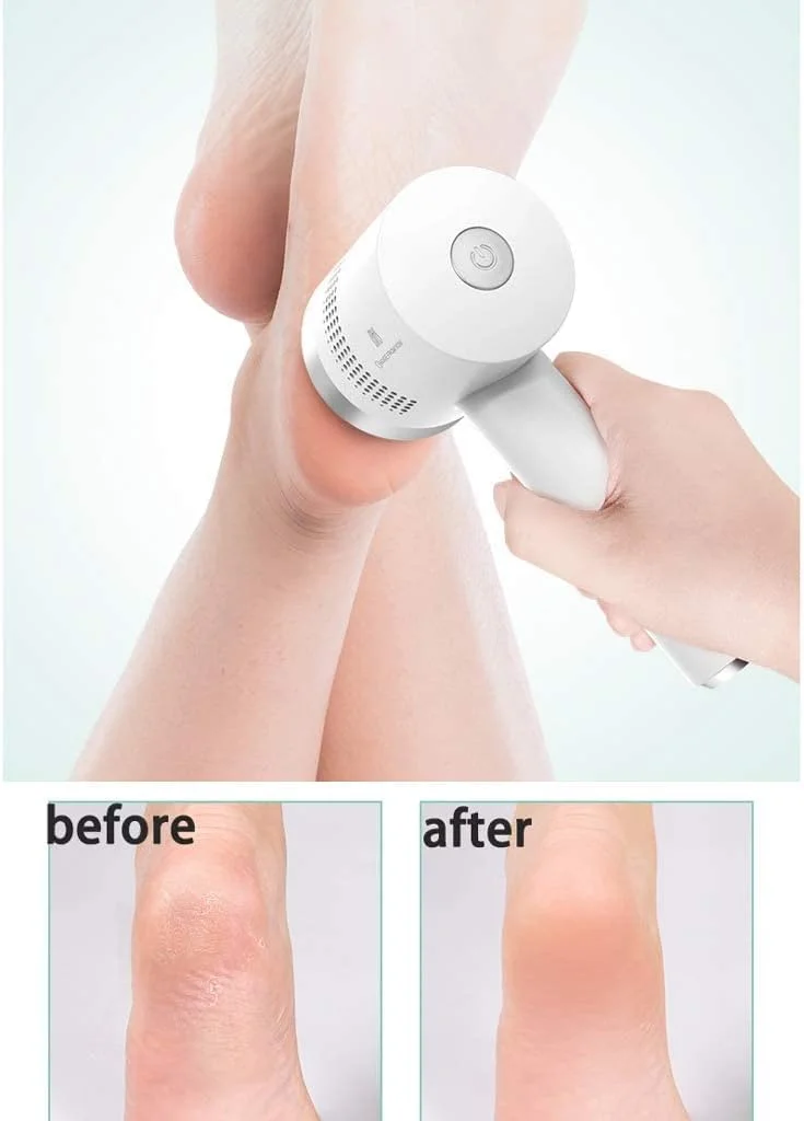 سوهان برقی پا AGAATI، از بین برنده پوست سخت، سنگ پا برقی با مکش خلاء، ابزار حرفه ای از بین برنده پینه پا، قابل شارژ با USB، 2 عدد (2 عدد) (1 عدد) (1 عدد)