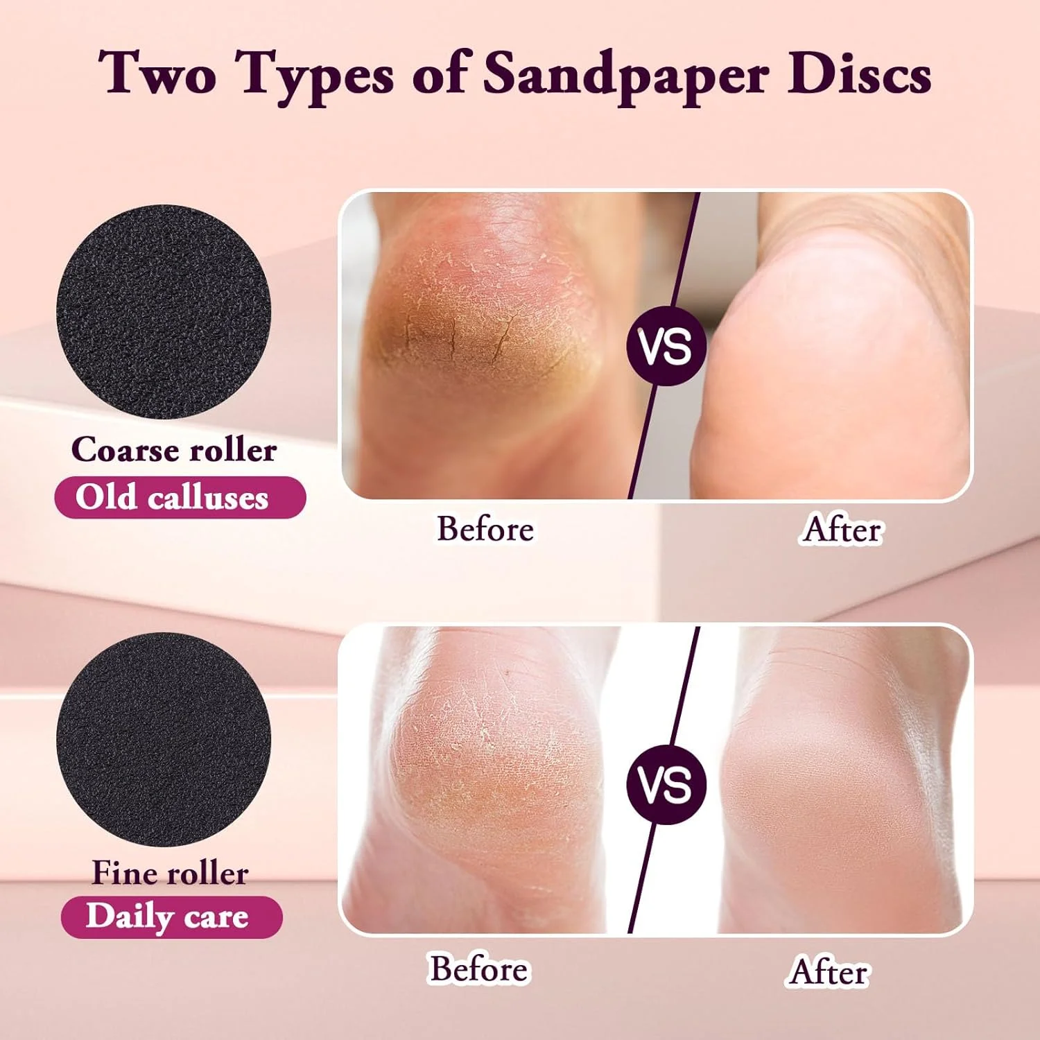 سوهان برقی پینه پا AFFLAT، سرعت قابل تنظیم (0-600 دور در دقیقه)، اسکرابر پای قابل تنظیم با 60 عدد دیسک سمباده، سوهان برقی پینه پا، ابزار پدیکور برای آقایان و بانوان، صورتی سوهان برقی پینه پا AFFLAT، سرعت قابل تنظیم (0-600 دور در دقیقه)، اسکرابر پای قابل تنظیم با 60 عدد دیسک سمباده، سوهان برقی پینه پا، ابزار پدیکور برای آقایان و بانوان، صورتی