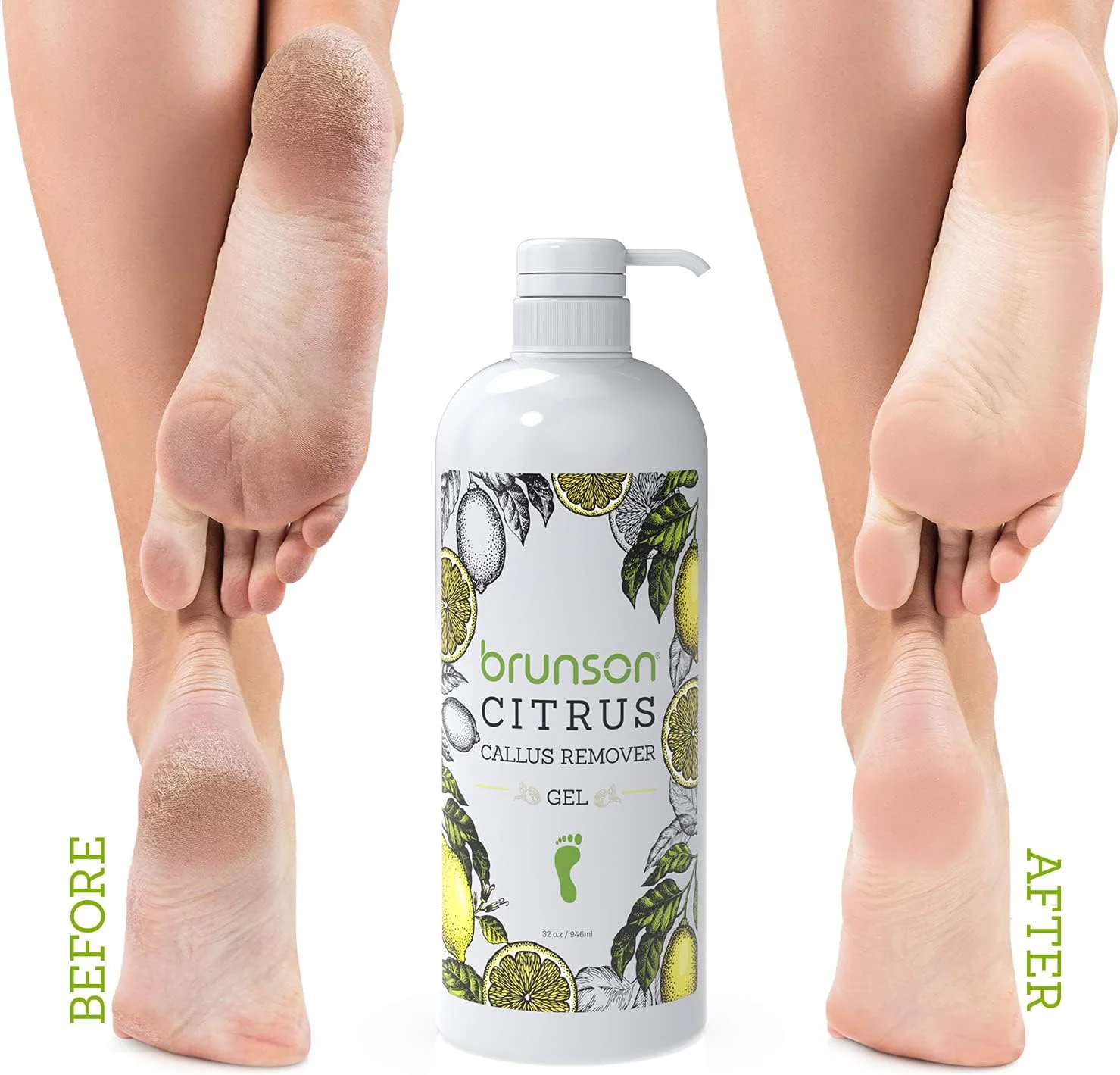 محلول از بین برنده پینه برانسون، از بین برنده پینه پا، مایع و ژل برای میخچه و پینه پا، عملکرد بهتر از رنده برقی و اسکرابر پا، 946 میلی لیتر محلول از بین برنده پینه برانسون، از بین برنده پینه پا، مایع و ژل برای میخچه و پینه پا، عملکرد بهتر از رنده برقی و اسکرابر پا، 946 میلی لیتر