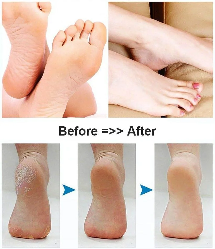 سوهان برقی پا BOMPOW، از بین برنده پینه پا، فایل پا شارژی، از بین برنده پوست سخت، ابزار پدیکور، کیت الکترونیکی از بین برنده پینه برای پاشنه های ترک خورده و پوست مرده با 2 سر غلتکی سوهان برقی پا BOMPOW، از بین برنده پینه پا، فایل پا شارژی، از بین برنده پوست سخت، ابزار پدیکور، کیت الکترونیکی از بین برنده پینه برای پاشنه های ترک خورده و پوست مرده با 2 سر غلتکی