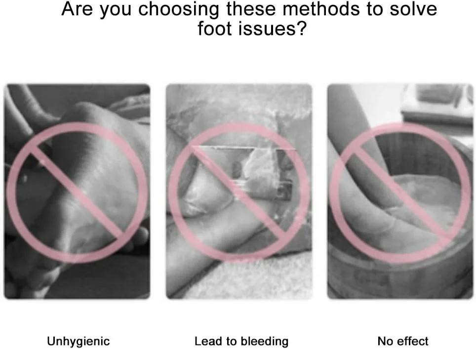سوهان برقی پا Dixacyer، سوهان برقی از بین برنده پینه پا، ست هدیه ابزار مراقبت از پدیکور، برقی قابل حمل برای آقایان و خانم ها (رنگ: طلایی)