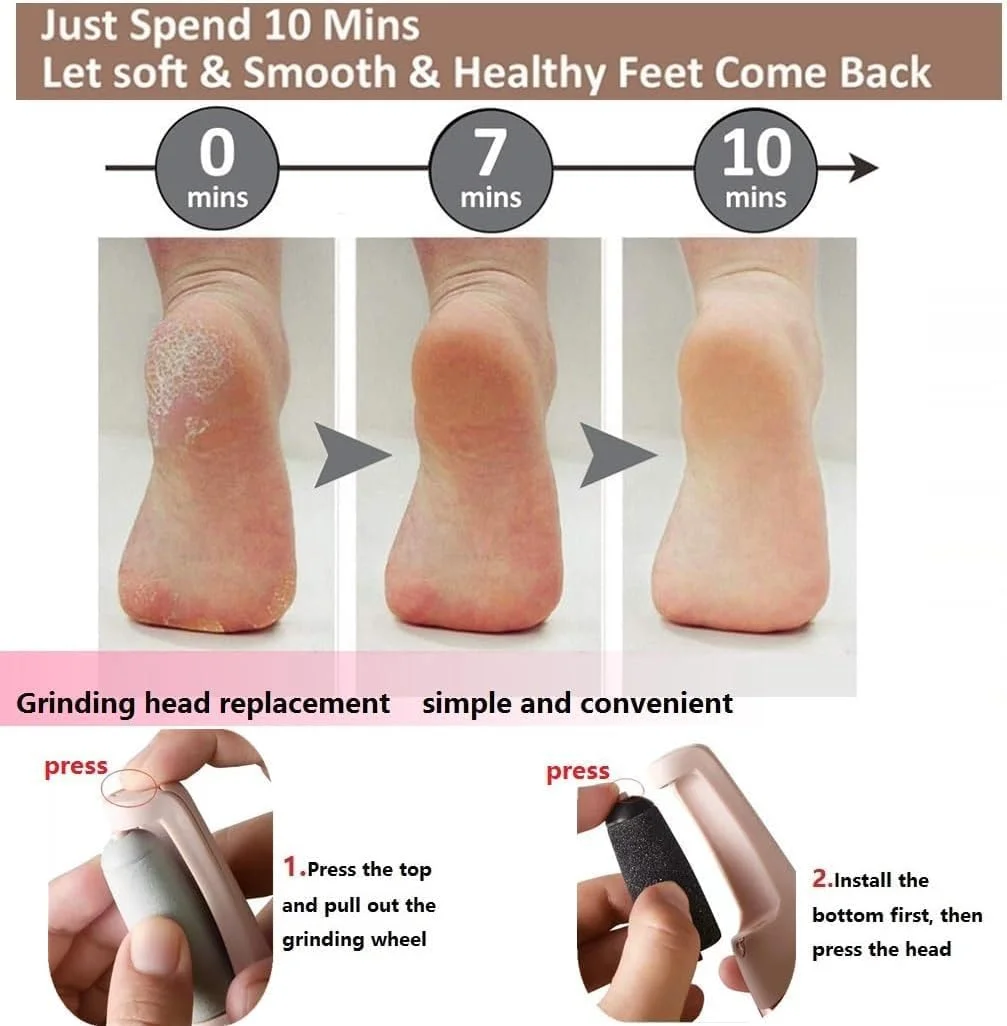 سوهان برقی کوچک از بین برنده پینه پا Derovan - کیت پدیکور فایل پا شارژی با 2 سری غلتکی، شارژ USB، ابزار حرفه ای مراقبت از پا سوهان برقی کوچک از بین برنده پینه پا Derovan - کیت پدیکور فایل پا شارژی با 2 سری غلتکی، شارژ USB، ابزار حرفه ای مراقبت از پا