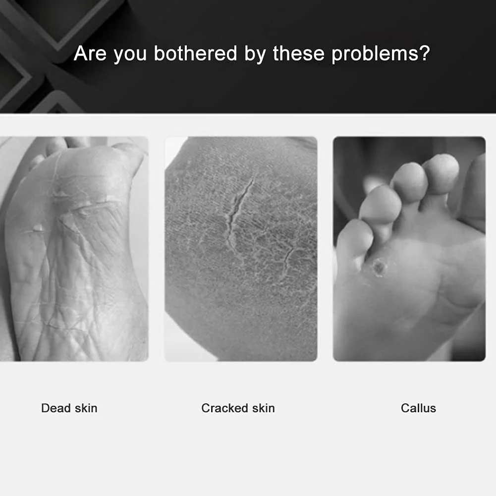 سوهان برقی پا Dixacyer، سوهان برقی از بین برنده پینه پا، ست هدیه ابزار مراقبت از پدیکور، برقی قابل حمل برای آقایان و خانم ها (رنگ: طلایی)