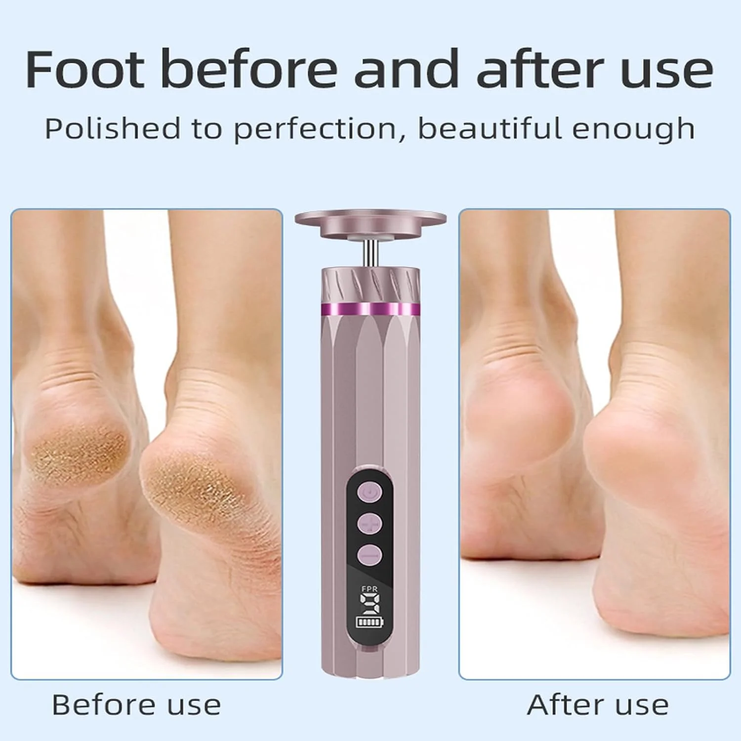 2 in 1 Electric Callus Remover for Feet 9 Speed Adjustable Professional Pedicure Tool Kit Foot Care for Dead, Cracked and Dry Skin 2 in 1 Electric Callus Remover for Feet 9 Speed Adjustable Professional Pedicure Tool Kit Foot Care for Dead, Cracked and Dry Skin
