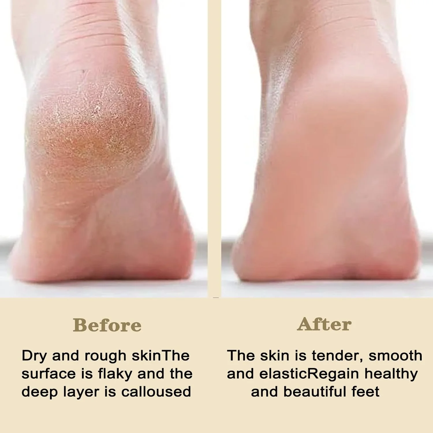 سوهان برقی پا، از بین برنده پوست سخت | دستگاه رفع پینه قابل شارژ با 30 دیسک سمباده، ابزار پدیکور 3 سرعته برای پوست مرده پا، پاشنه های ترک خورده، مراقبت صاف سوهان برقی پا، از بین برنده پوست سخت | دستگاه رفع پینه قابل شارژ با 30 دیسک سمباده، ابزار پدیکور 3 سرعته برای پوست مرده پا، پاشنه های ترک خورده، مراقبت صاف