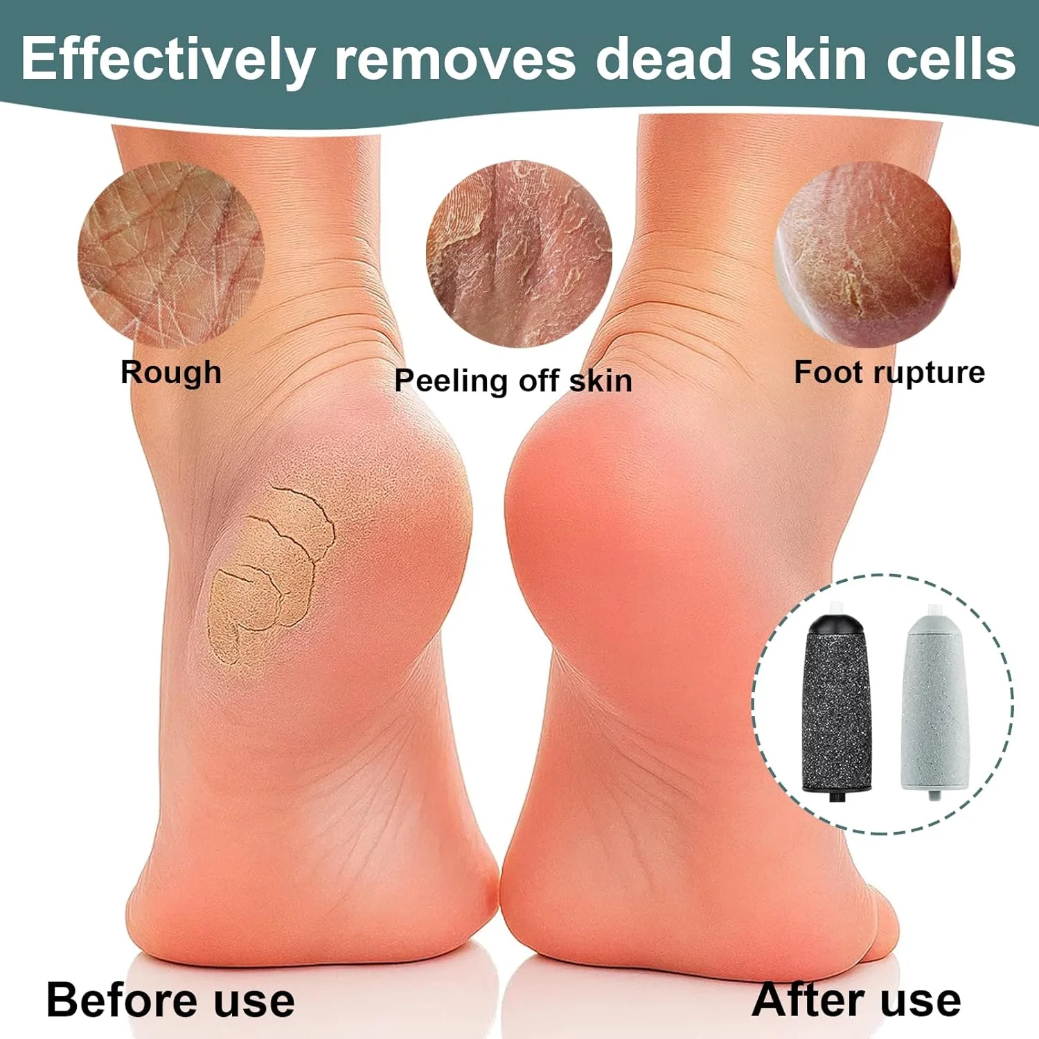 BOULESENM 6 عدد سری یدکی پدیکور، از بین برنده پینه، غلتک های یدکی برقی، پدهای یدکی برقی از بین برنده پینه پا با 3 سر دانه درشت و 3 سر دانه ریز (پدیکور) BOULESENM 6 عدد سری یدکی پدیکور، از بین برنده پینه، غلتک های یدکی برقی، پدهای یدکی برقی از بین برنده پینه پا با 3 سر دانه درشت و 3 سر دانه ریز (پدیکور)