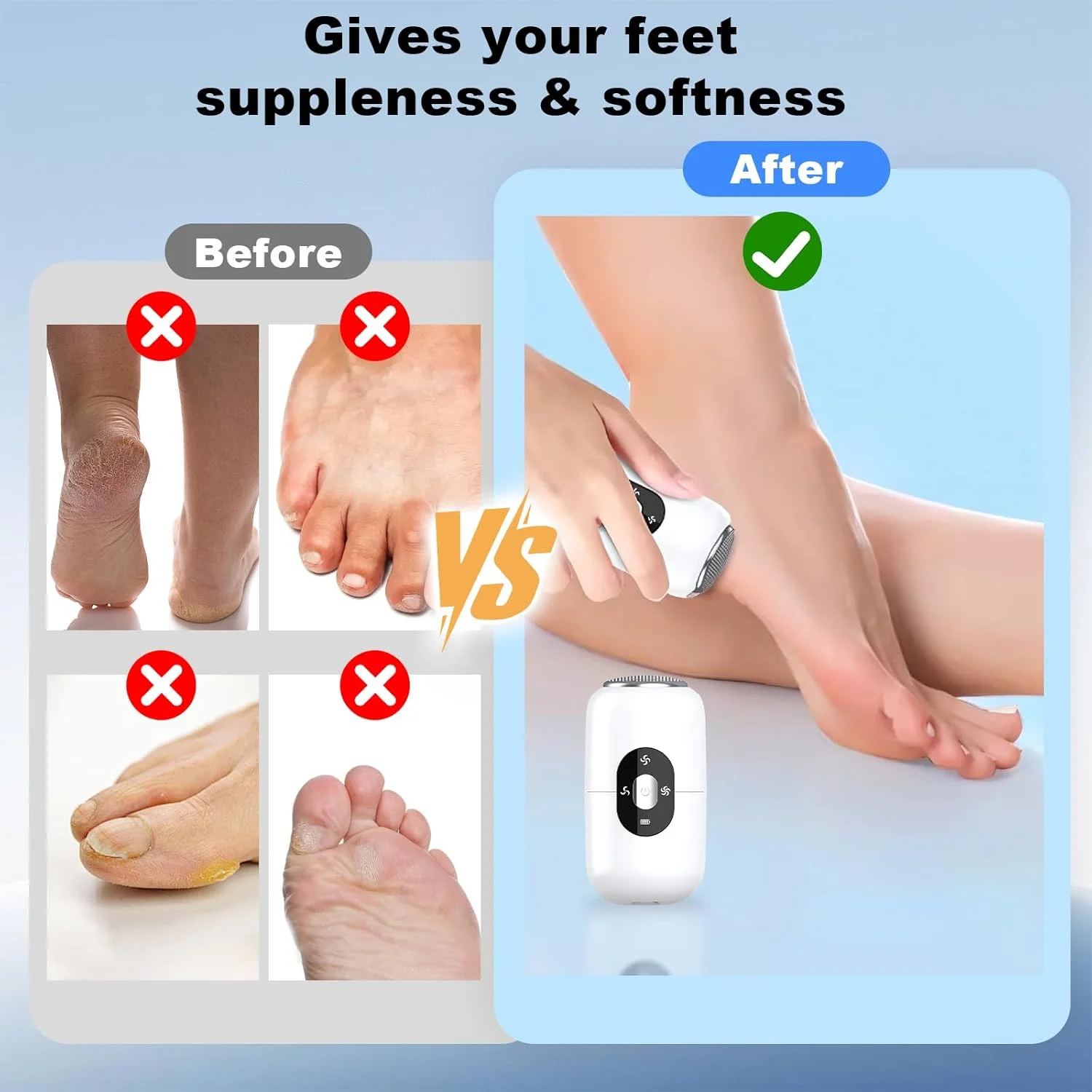 سوهان برقی پینه پا، دستگاه برقی از بین بردن پینه پا با 2 سری سنگ زنی استیل ضد زنگ، 3 سطح قابل تنظیم، سوهان برقی پینه پا قابل شارژ برای پاشنه های ترک خورده، شاخی سوهان برقی پینه پا، دستگاه برقی از بین بردن پینه پا با 2 سری سنگ زنی استیل ضد زنگ، 3 سطح قابل تنظیم، سوهان برقی پینه پا قابل شارژ برای پاشنه های ترک خورده، شاخی