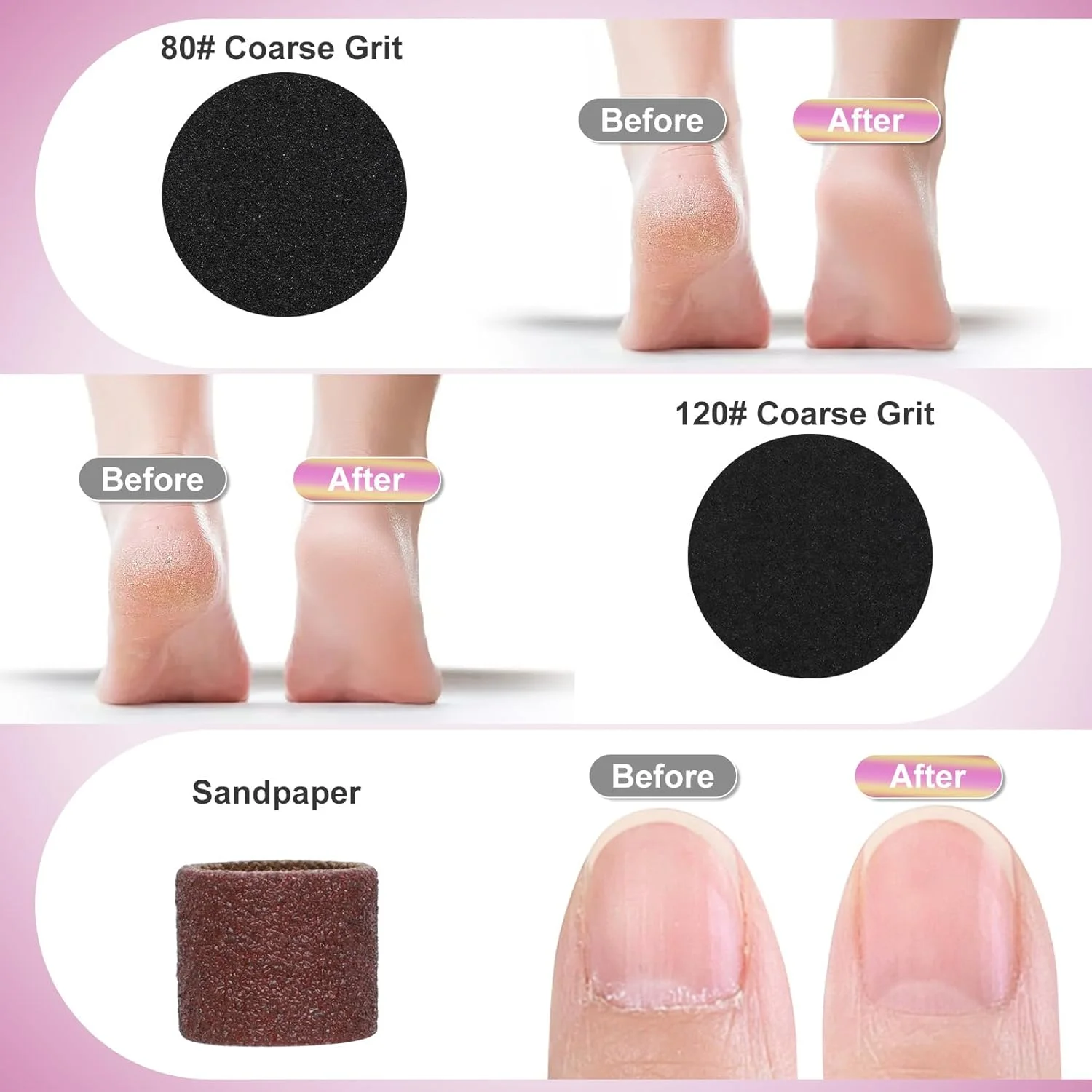 سوهان برقی پینه پا 2 در 1 AiQInu، مجموعه سوهان برقی شارژی پا، 9 سرعت قابل تنظیم، با نمایشگر LED، برای پاشنه ترک خورده، پینه (خاکستری) سوهان برقی پینه پا 2 در 1 AiQInu، مجموعه سوهان برقی شارژی پا، 9 سرعت قابل تنظیم، با نمایشگر LED، برای پاشنه ترک خورده، پینه (خاکستری)