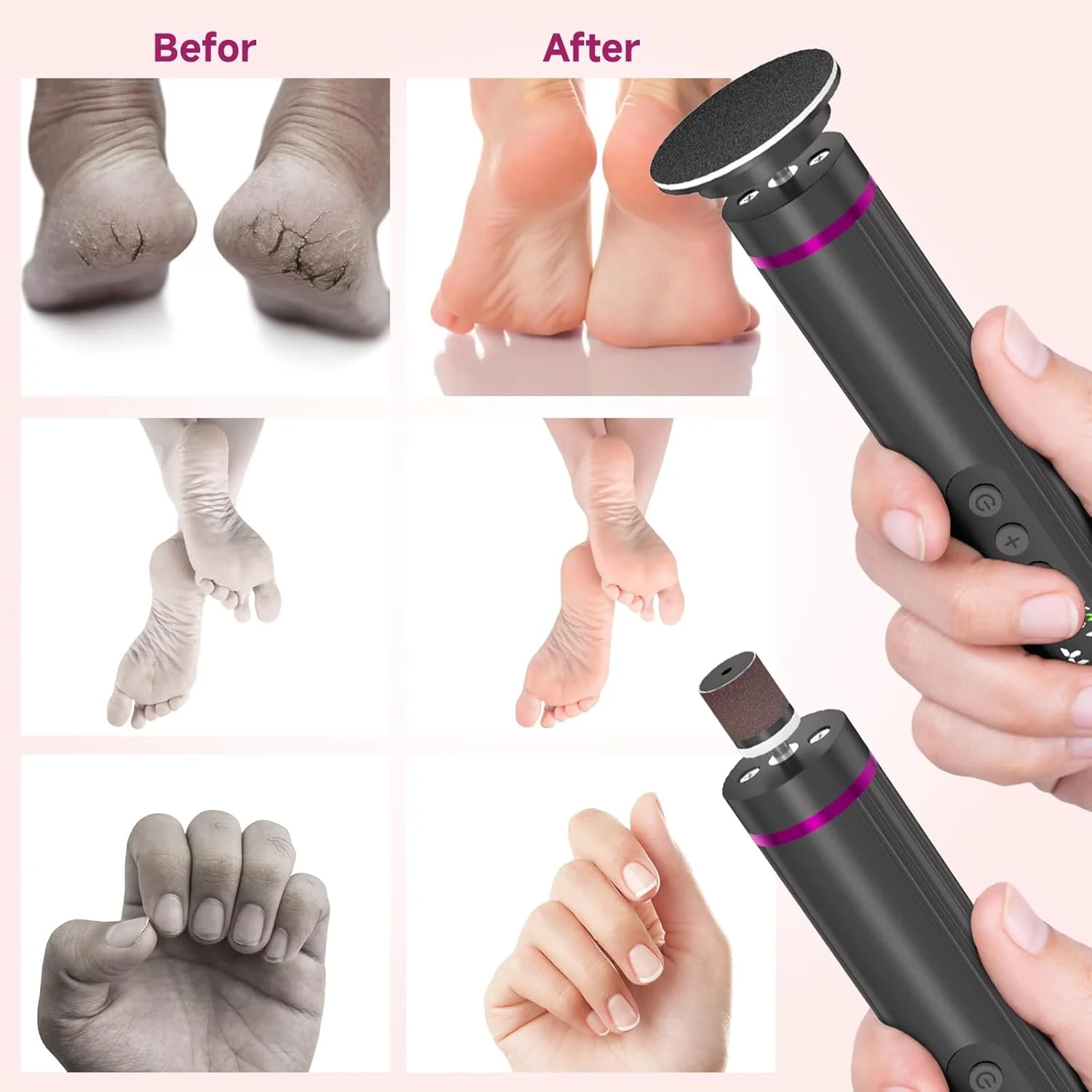 Electric Foot File, 2 in 1 Dermave Electric Foot Callus Remover, Adjustable Speed Foot Filer w/Sandpaper Discs & Grinding Heads, 9 Speeds Professional Pedicure Tool for Feet Dead Skin Calluses(Gray) Electric Foot File, 2 in 1 Dermave Electric Foot Callus Remover, Adjustable Speed Foot Filer w/Sandpaper Discs & Grinding Heads, 9 Speeds Professional Pedicure Tool for Feet Dead Skin Calluses(Gray)