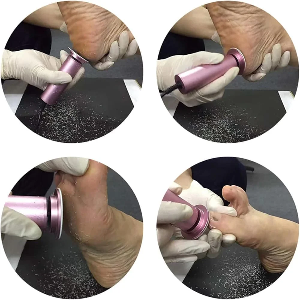 Electric Foot File, Callus Remover for Feet, Adjustable Speed Foot File with 60 Pcs Sandpaper Discs, Stepless Speed Control Pedicure Tools, Professional Pedicure Tool for Dead Skin and Calluses Electric Foot File, Callus Remover for Feet, Adjustable Speed Foot File with 60 Pcs Sandpaper Discs, Stepless Speed Control Pedicure Tools, Professional Pedicure Tool for Dead Skin and Calluses