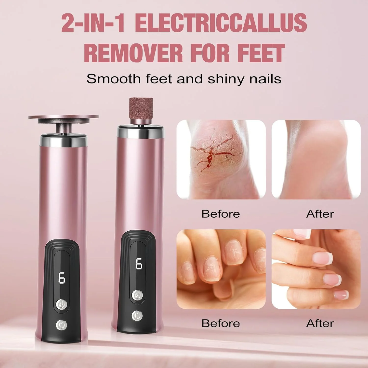 Callus Remover for feet, Electric Foot Callus Remover, Foot File with 9 Adjustable Speed, Foot Scrubber Scraper with 2 Grinding Heads & Sandpaper Discs, Pedicure Tools for feet with Digital Display Callus Remover for feet, Electric Foot Callus Remover, Foot File with 9 Adjustable Speed, Foot Scrubber Scraper with 2 Grinding Heads & Sandpaper Discs, Pedicure Tools for feet with Digital Display