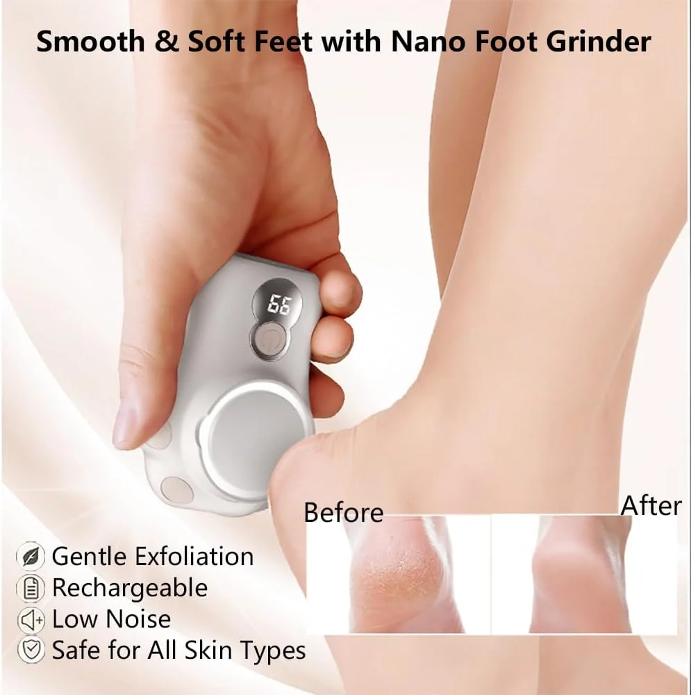 سوهان برقی پینه پا - سوهان پای شارژی طرح پنجه گربه با 3 سری غلتکی، نمایشگر دیجیتال، 3 سرعت و نورپردازی - پدیکور ملایم برای پوست مرده، پینه ها و پاشنه های خشک سوهان برقی پینه پا - سوهان پای شارژی طرح پنجه گربه با 3 سری غلتکی، نمایشگر دیجیتال، 3 سرعت و نورپردازی - پدیکور ملایم برای پوست مرده، پینه ها و پاشنه های خشک