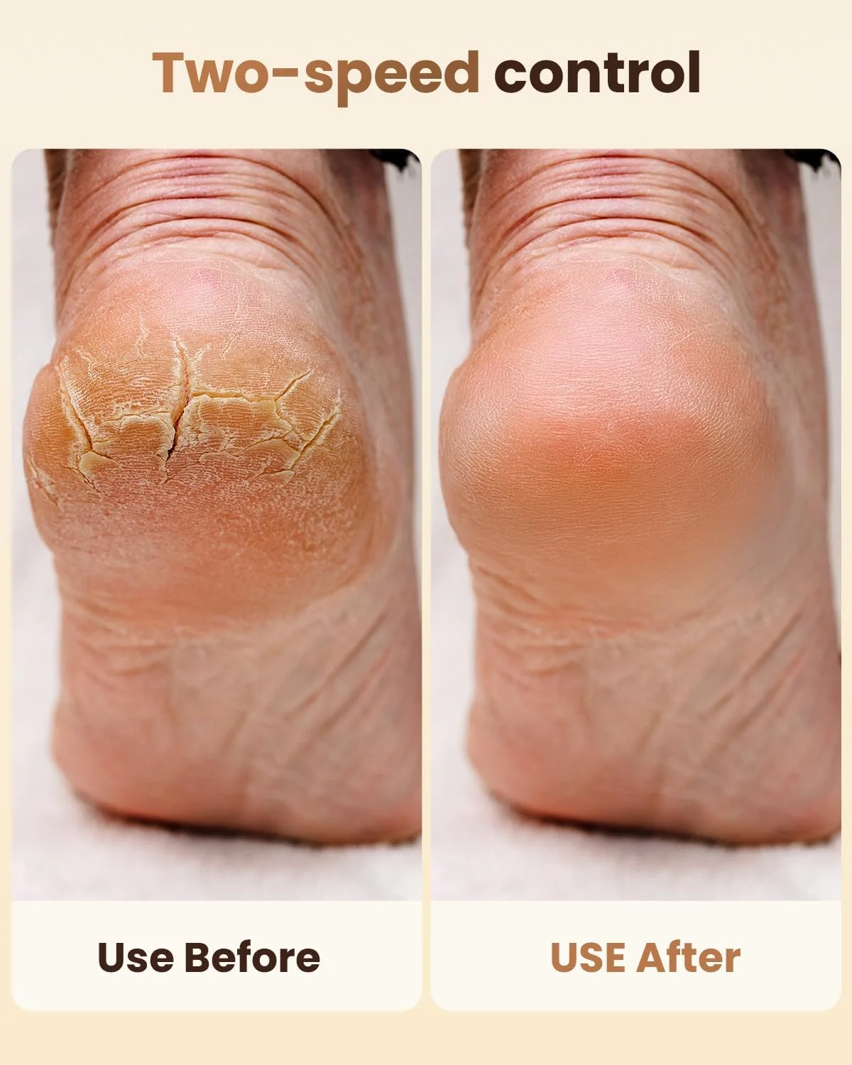 سوهان برقی پا - کیت پدیکور شارژی 2 سرعته با 3 غلتک، اسکرابر ضد آب IPX4 و نمایشگر دیجیتال | از بین برنده حرفه ای پوست مرده و پینه برای زنان/مردان سوهان برقی پا - کیت پدیکور شارژی 2 سرعته با 3 غلتک، اسکرابر ضد آب IPX4 و نمایشگر دیجیتال | از بین برنده حرفه ای پوست مرده و پینه برای زنان/مردان