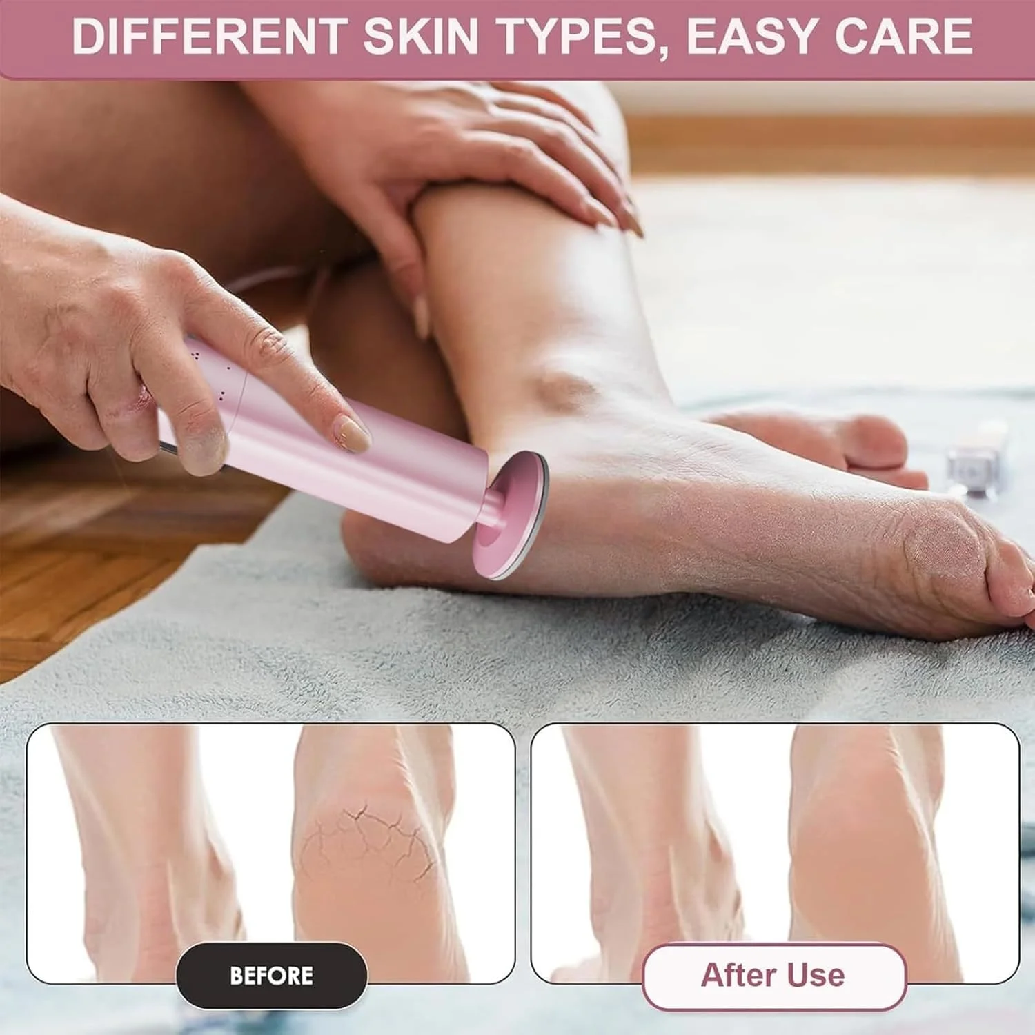 سوهان برقی پا | از بین برنده پینه پا و پاشنه ترک خورده - ابزار پدیکور با سرهای قابل تعویض برای داشتن پوستی صاف و شاداب سوهان برقی پا | از بین برنده پینه پا و پاشنه ترک خورده - ابزار پدیکور با سرهای قابل تعویض برای داشتن پوستی صاف و شاداب