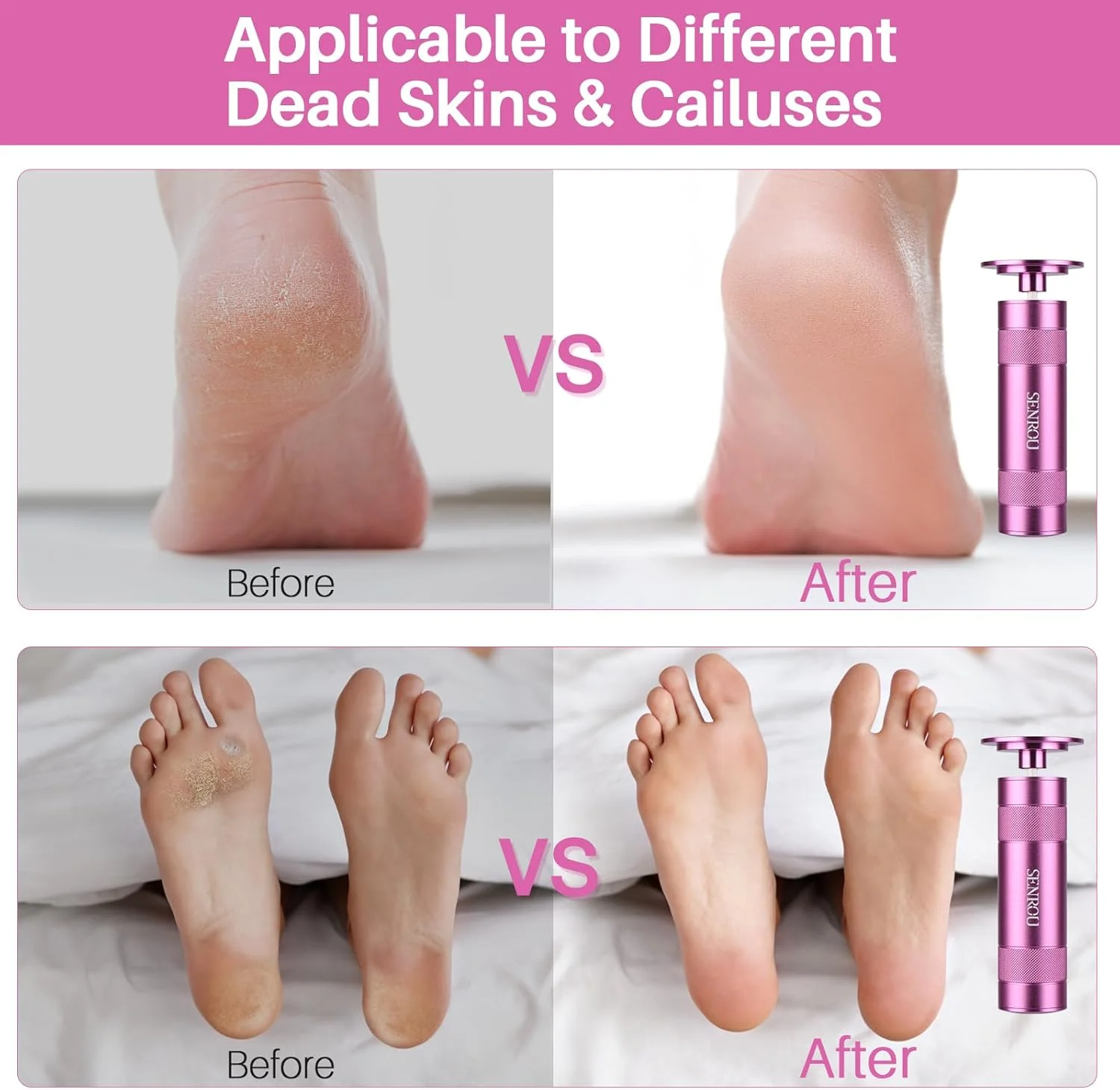 سوهان برقی پدیکور پا، سوهان برقی 2 در 1 پا/سوهان ناخن، از بین برنده پینه پا با 60 عدد + 12 عدد دیسک سمباده، ابزار ترمیم پا، صورتی سوهان برقی پدیکور پا، سوهان برقی 2 در 1 پا/سوهان ناخن، از بین برنده پینه پا با 60 عدد + 12 عدد دیسک سمباده، ابزار ترمیم پا، صورتی