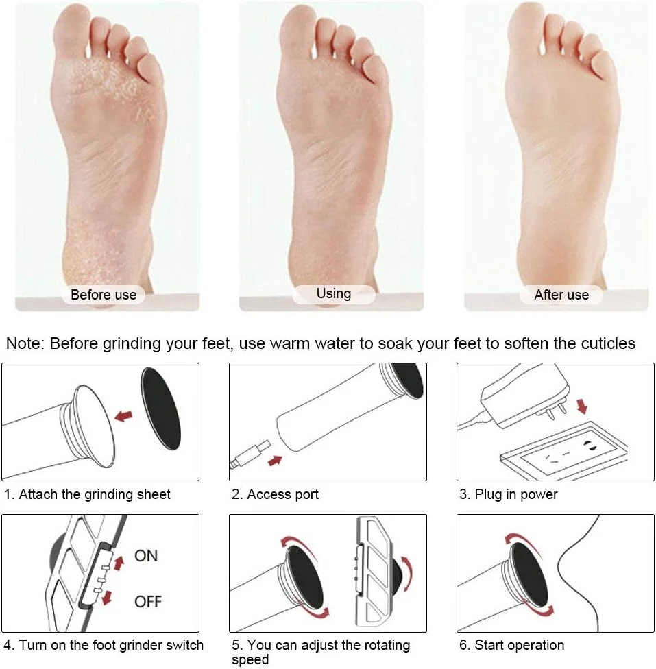 Electric Foot File, Exfoliate Callus Remover, Electric Foot Callus Remover, Foot Pedicure Tool Foot Grinding Machine for Cracked Dry Skin(US)