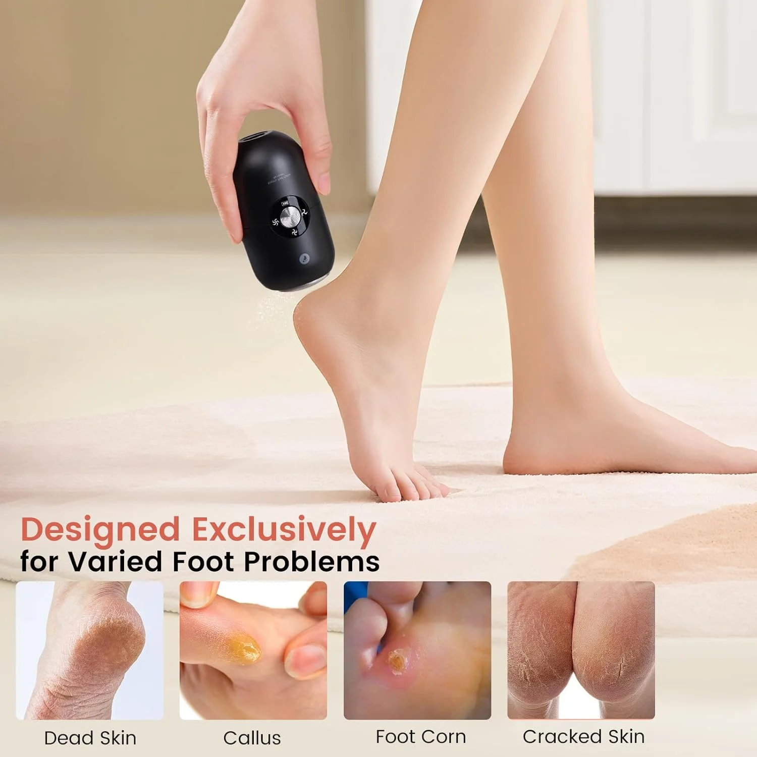 سوهان برقی پا از بین برنده پینه پا برای بانوان (مشکی)