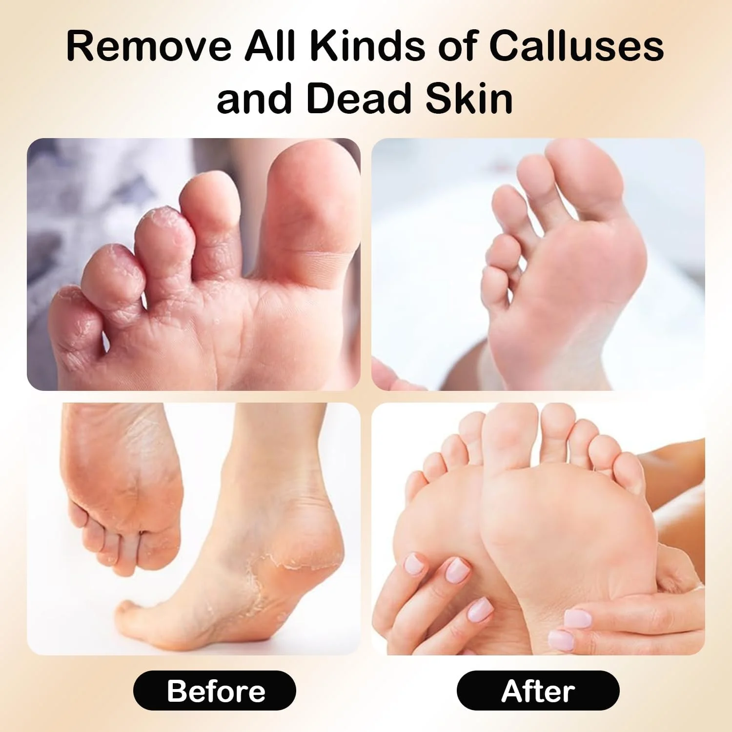 سوهان برقی پدیکور پا، سوهان برقی 2 در 1، سرعت قابل تنظیم، ابزار مراقبت از پا، ست حرفه ای حذف پینه برقی، مناسب برای پوست مرده، پوست سخت، پوست ترک خورده (مشکی) سوهان برقی پدیکور پا، سوهان برقی 2 در 1، سرعت قابل تنظیم، ابزار مراقبت از پا، ست حرفه ای حذف پینه برقی، مناسب برای پوست مرده، پوست سخت، پوست ترک خورده (مشکی)