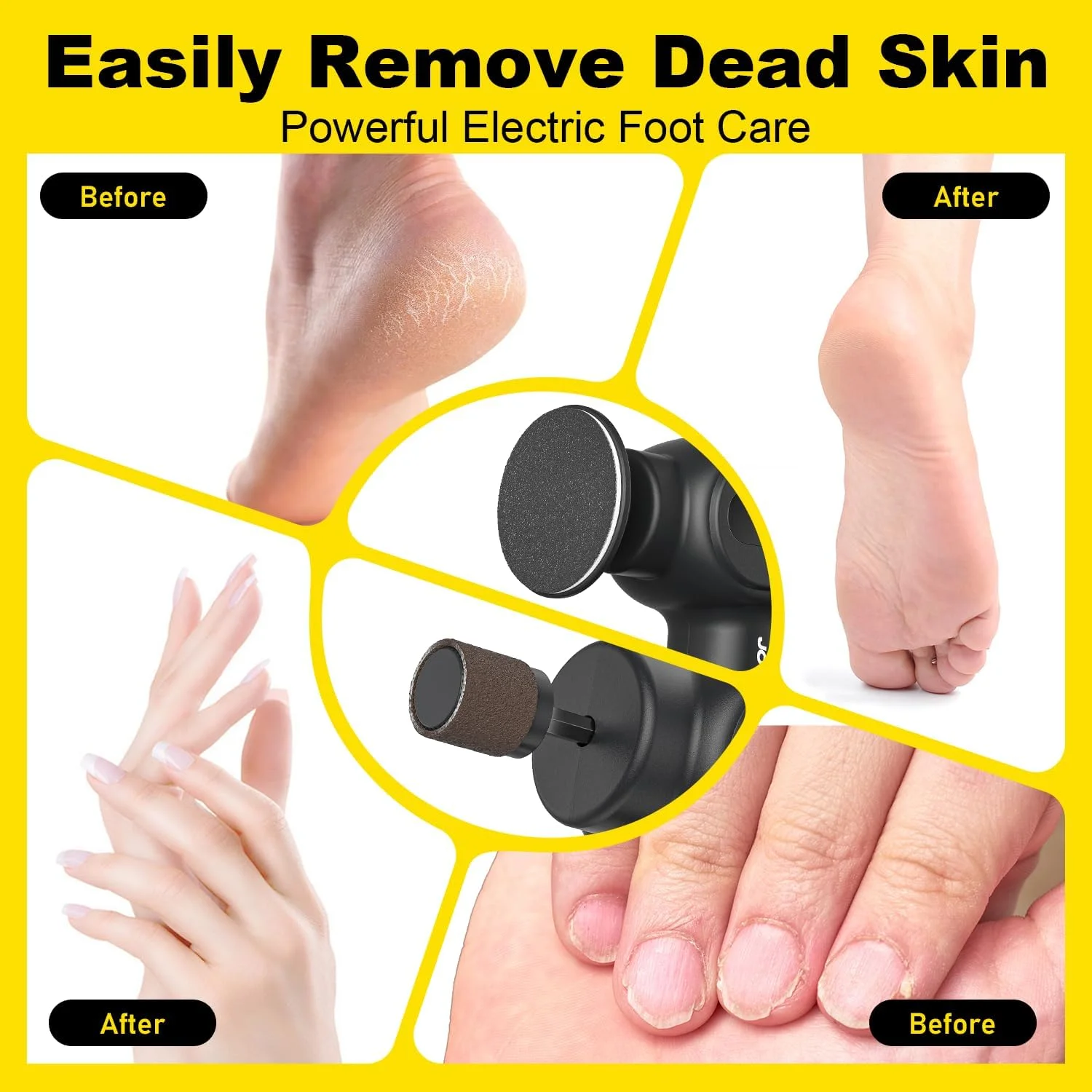 سوهان برقی پا شارژی، ابزار پدیکور برقی پا، سنگ پای برقی 2 در 1، کیت اسکرابر حرفه ای پا برای پوست های مرده، سفت و ترک خورده، با 6 سرعت و 20 دیسک سمباده سوهان برقی پا شارژی، ابزار پدیکور برقی پا، سنگ پای برقی 2 در 1، کیت اسکرابر حرفه ای پا برای پوست های مرده، سفت و ترک خورده، با 6 سرعت و 20 دیسک سمباده