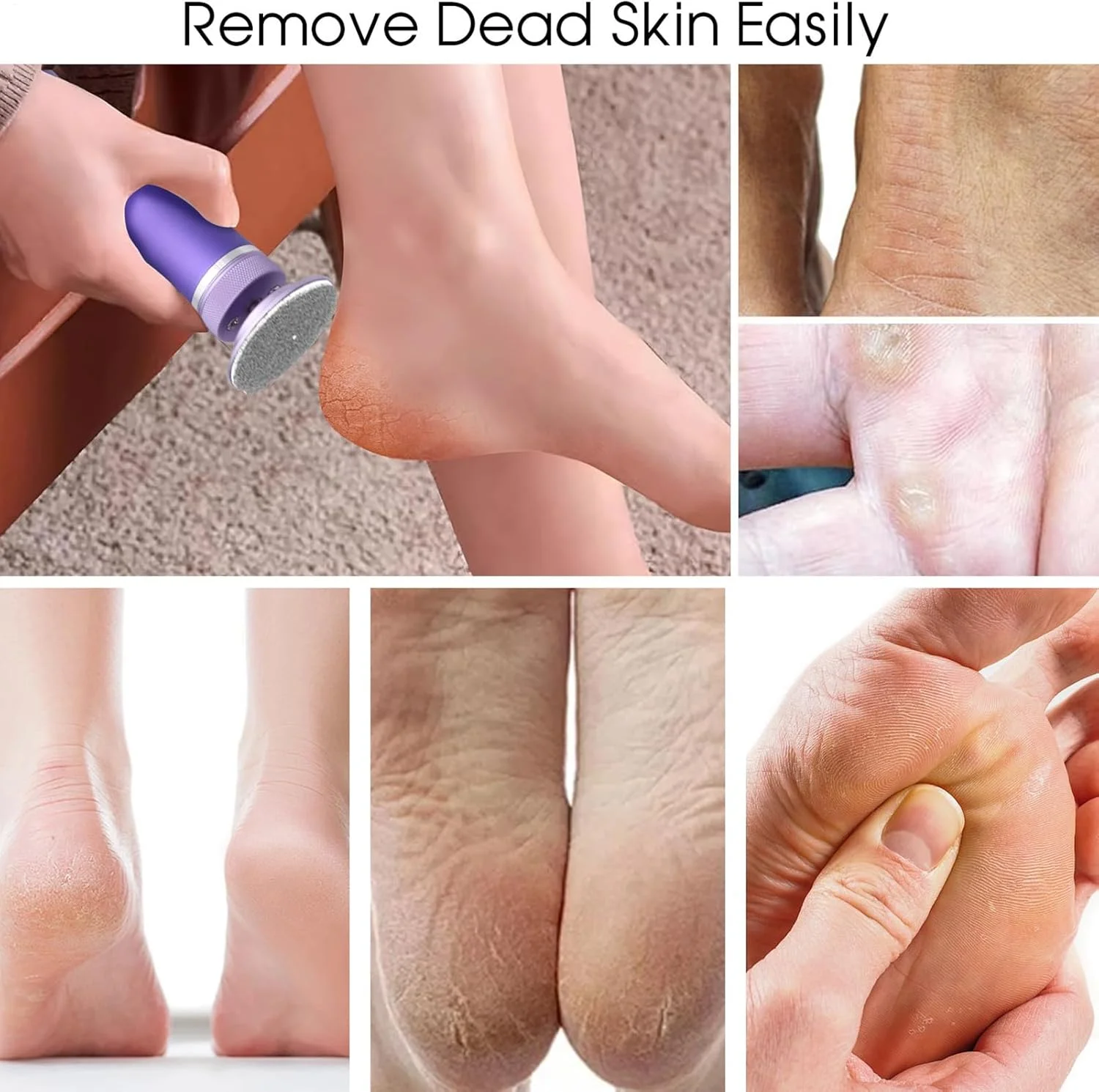 سوهان برقی پا | ابزار از بین بردن پینه پا | سنگ پا برقی قابل شارژ با 12 سرعت قابل تنظیم، لایه بردار و قابل حمل مناسب پاشنه پا برای ورزشکاران، سالمندان، سالن های اسپا، پدیکور بانوان و استفاده در منزل سوهان برقی پا | ابزار از بین بردن پینه پا | سنگ پا برقی قابل شارژ با 12 سرعت قابل تنظیم، لایه بردار و قابل حمل مناسب پاشنه پا برای ورزشکاران، سالمندان، سالن های اسپا، پدیکور بانوان و استفاده در منزل