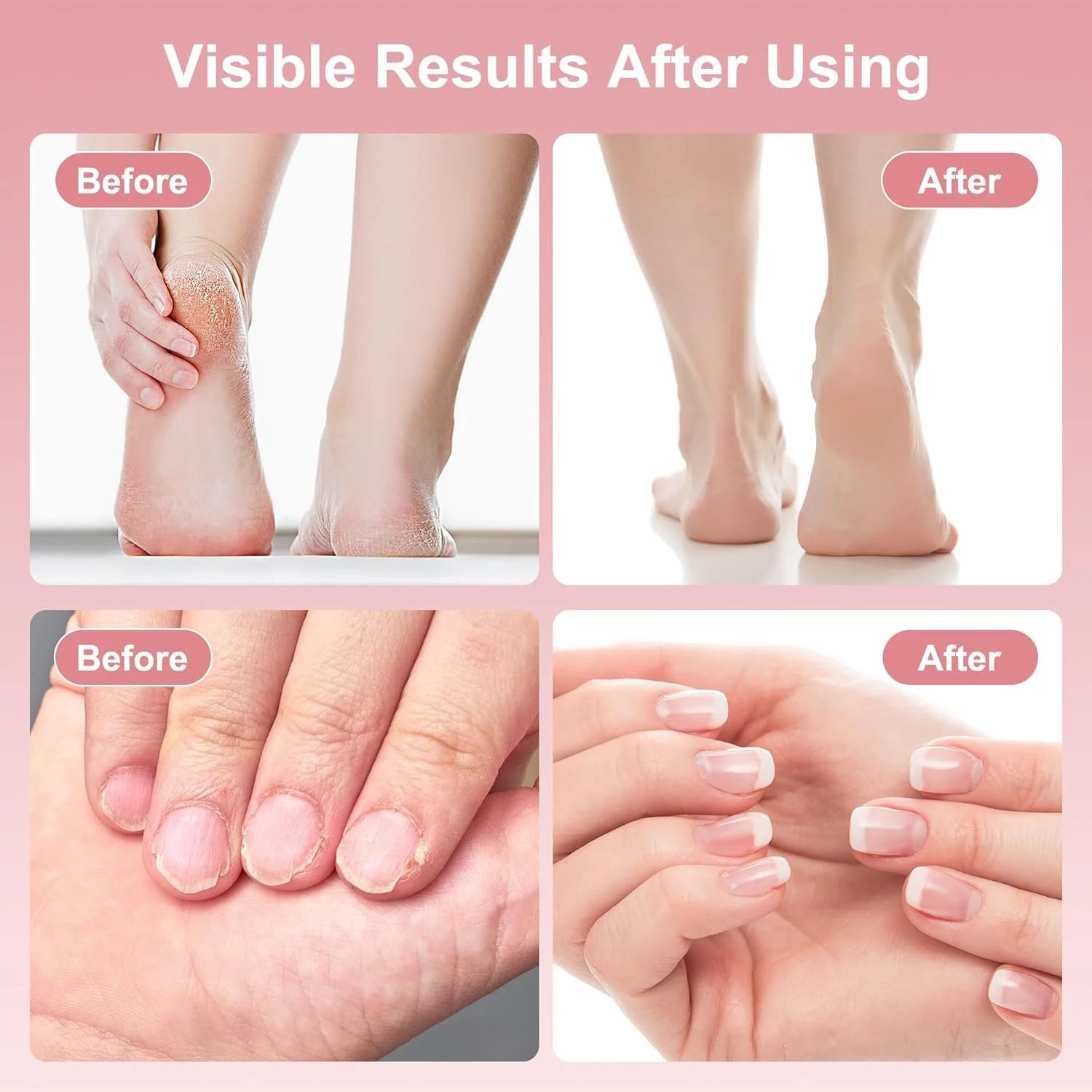 سوهان برقی پا، سوهان شارژی 2 در 1 برای از بین بردن پینه پا و ناخن، سوهان پینه با کنترل 9 سرعته به همراه 60 دیسک سمباده، ابزار پدیکور بی سیم برای