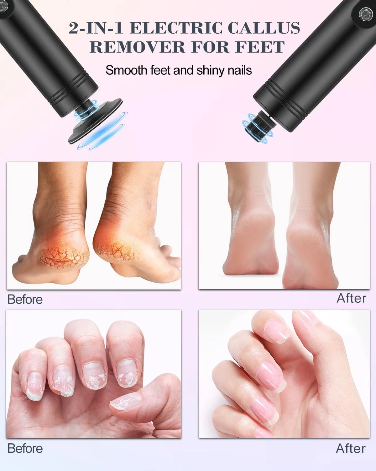 سوهان برقی پا، 6 سرعته، سوهان پا و سنگ ناخن 2 در 1، سمباده برقی پا شارژی با دیسک های سمباده و مته، رزگلد