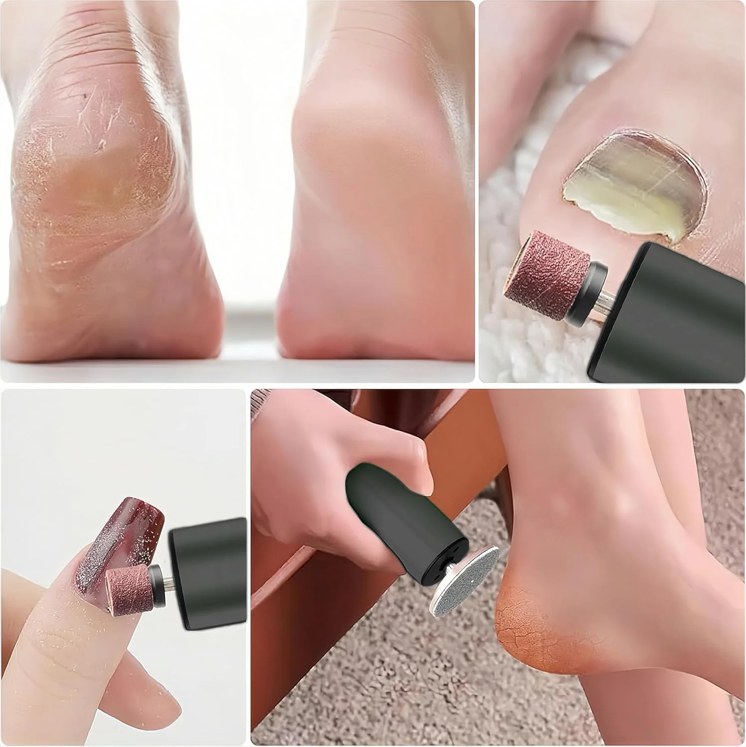 سوهان برقی پا، ابزار سنباده ناخن و سنگ پای 2 در 1 با سرعت 6 دنده، ابزار پدیکور حذف پوست مرده شارژی با 20 عدد دیسک سنباده و 20 عدد حلقه سنباده سوهان برقی پا، ابزار سنباده ناخن و سنگ پای 2 در 1 با سرعت 6 دنده، ابزار پدیکور حذف پوست مرده شارژی با 20 عدد دیسک سنباده و 20 عدد حلقه سنباده