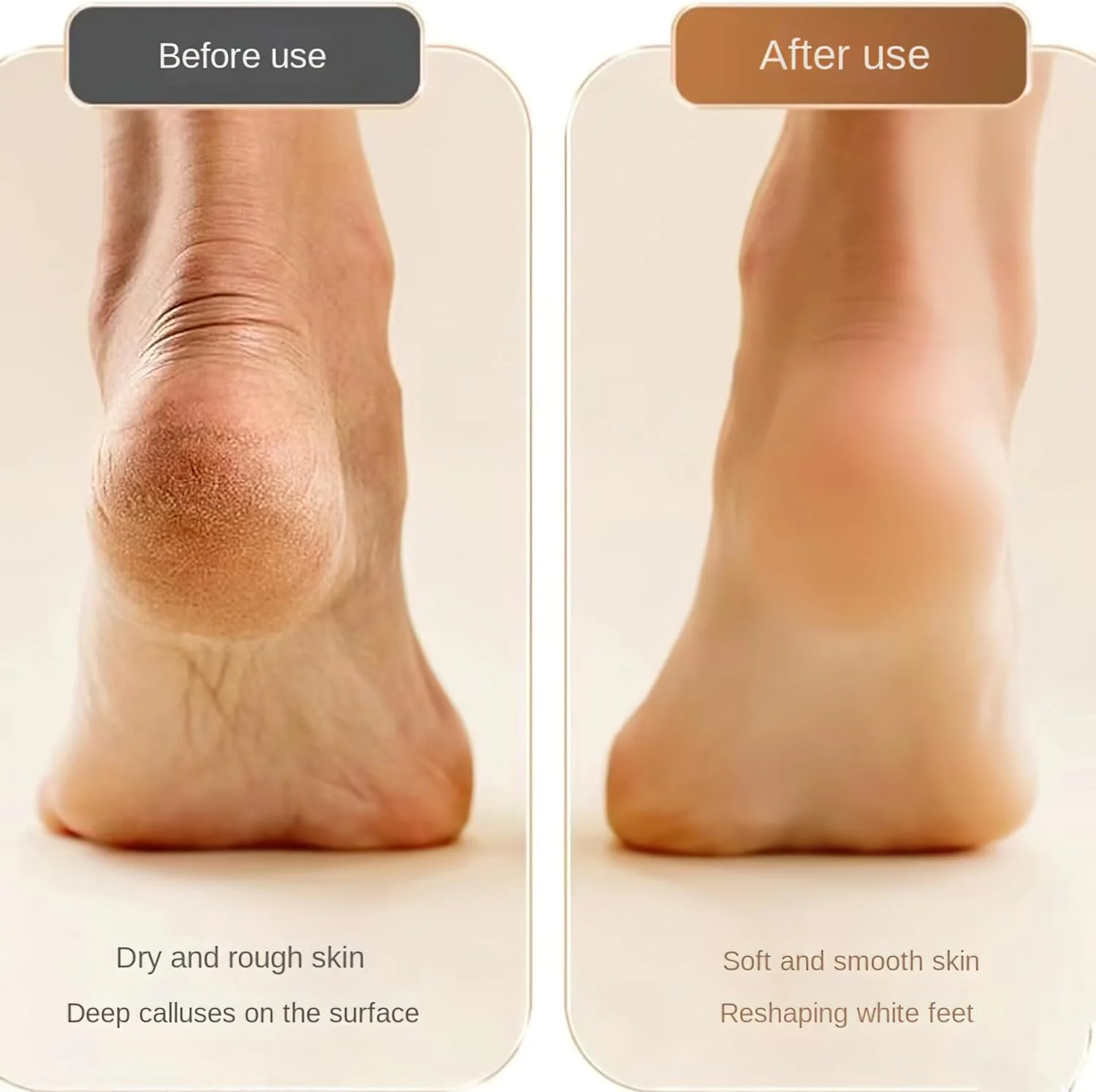 سوهان برقی پدیکور پا مدل 2025، اسکرابر و فایل پا، از بین برنده پوست مرده پا، سمباده پا، از بین برنده زگیل کف پا، تراشنده پینه پا (نارنجی)