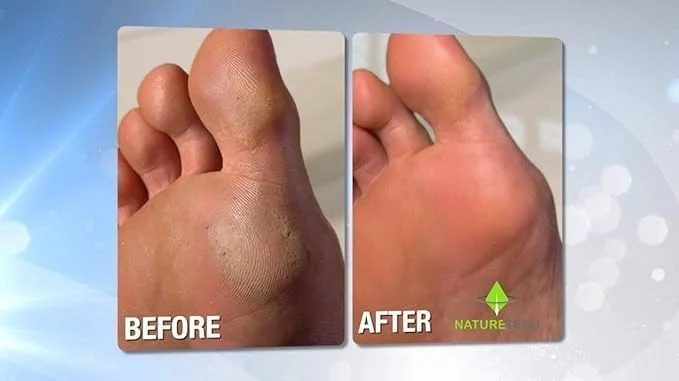 سوهان برقی پا، کیت مراقبت از پا، قابل حمل و شارژی، ابزار مراقبت از پا برای پاشنه های ترک خورده و پوست مرده (آبی)