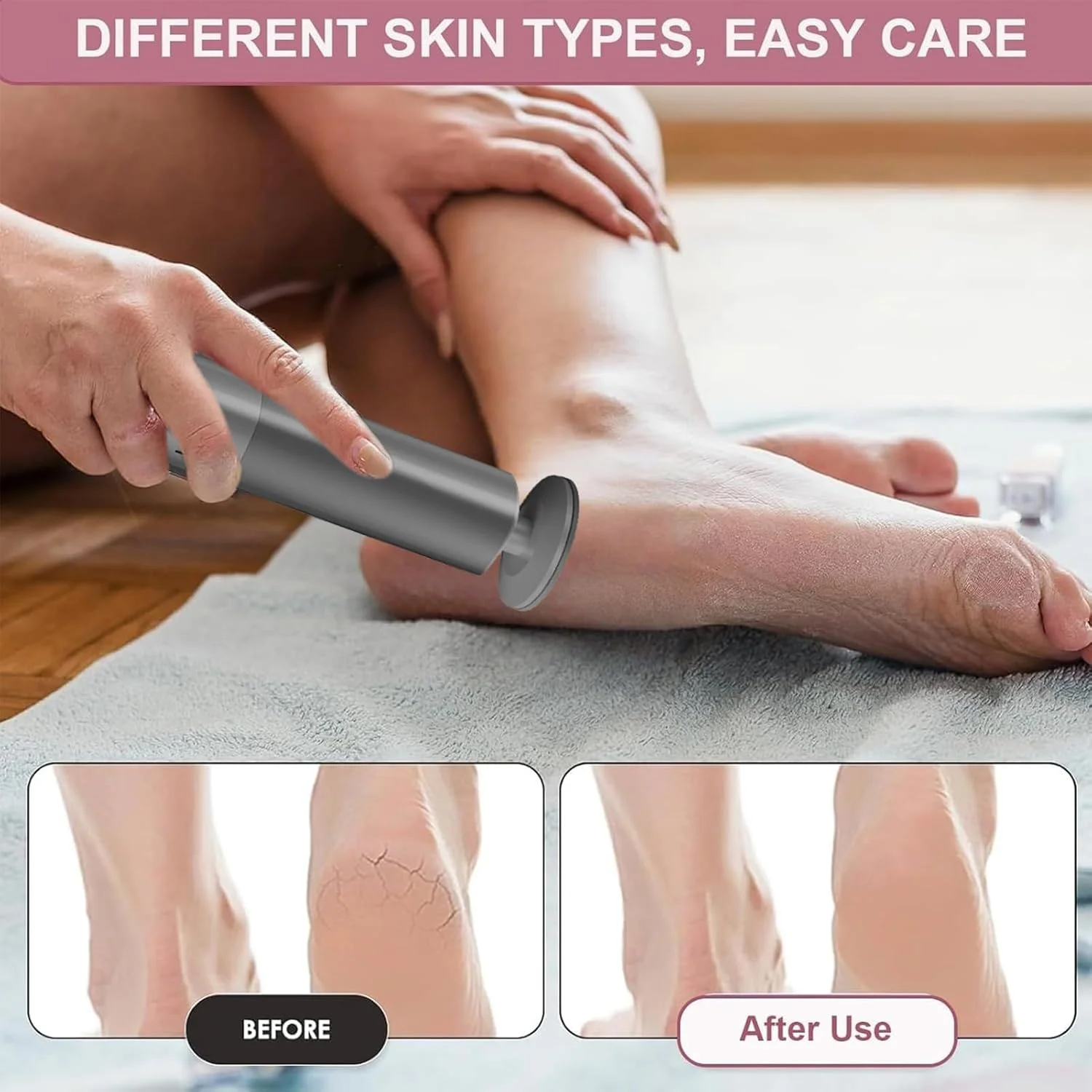 سوهان برقی پا، از بین برنده پینه پا | ابزار پدیکور با سرهای قابل تعویض برای پوستی صاف و شاداب سوهان برقی پا، از بین برنده پینه پا | ابزار پدیکور با سرهای قابل تعویض برای پوستی صاف و شاداب