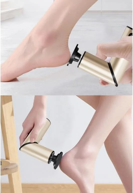 دستگاه پدیکور برقی 9 سرعته فساکوز، از بین برنده پینه پا با عملکرد باتری، دسته محوری و چرخش به جلو/عقب