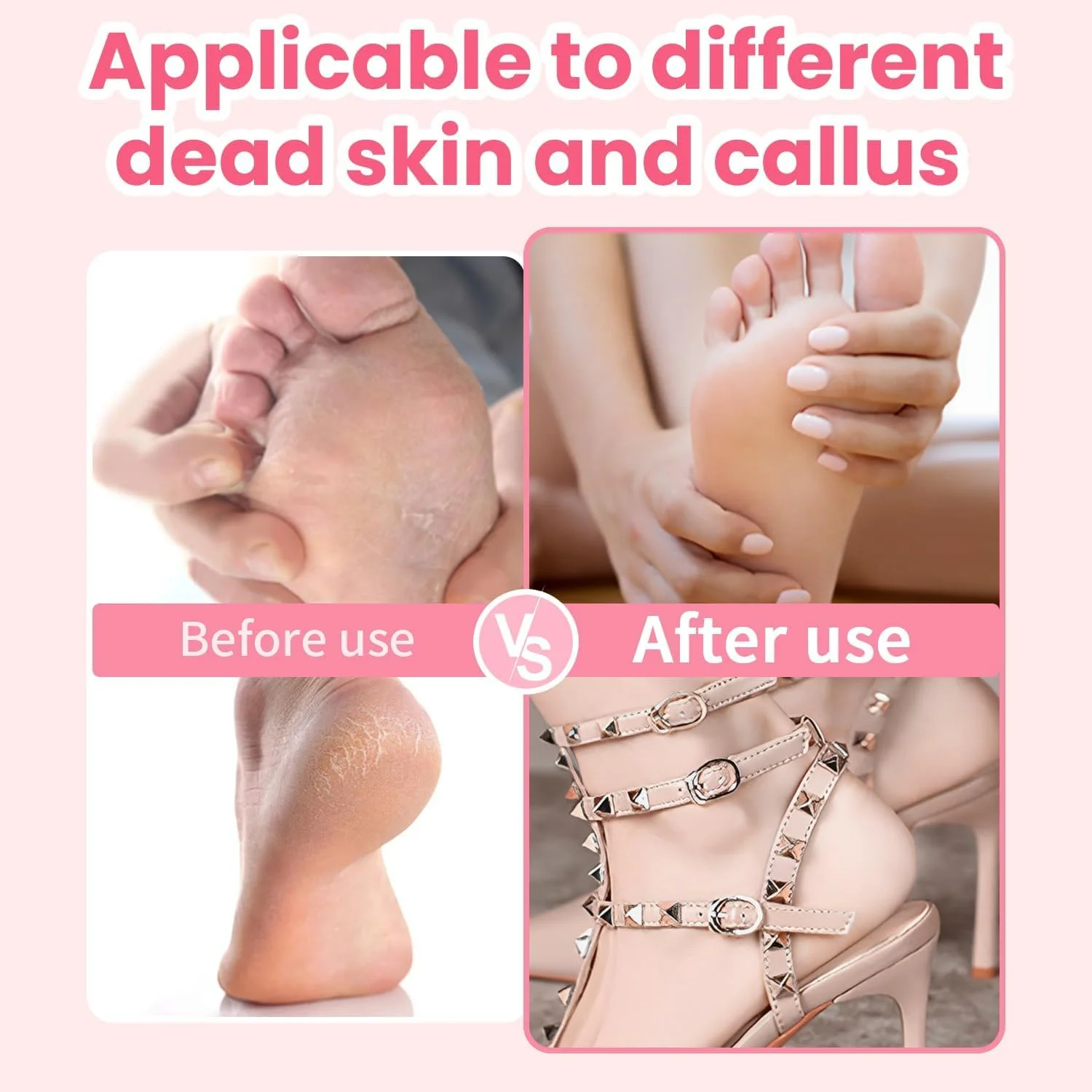 سوهان برقی پینه پا FHNUVB، سوهان برقی قدرتمند پا برای از بین بردن بدون درد پینه های حرفه ای پا، دارای 60 دیسک سمباده، سرعت قابل تنظیم