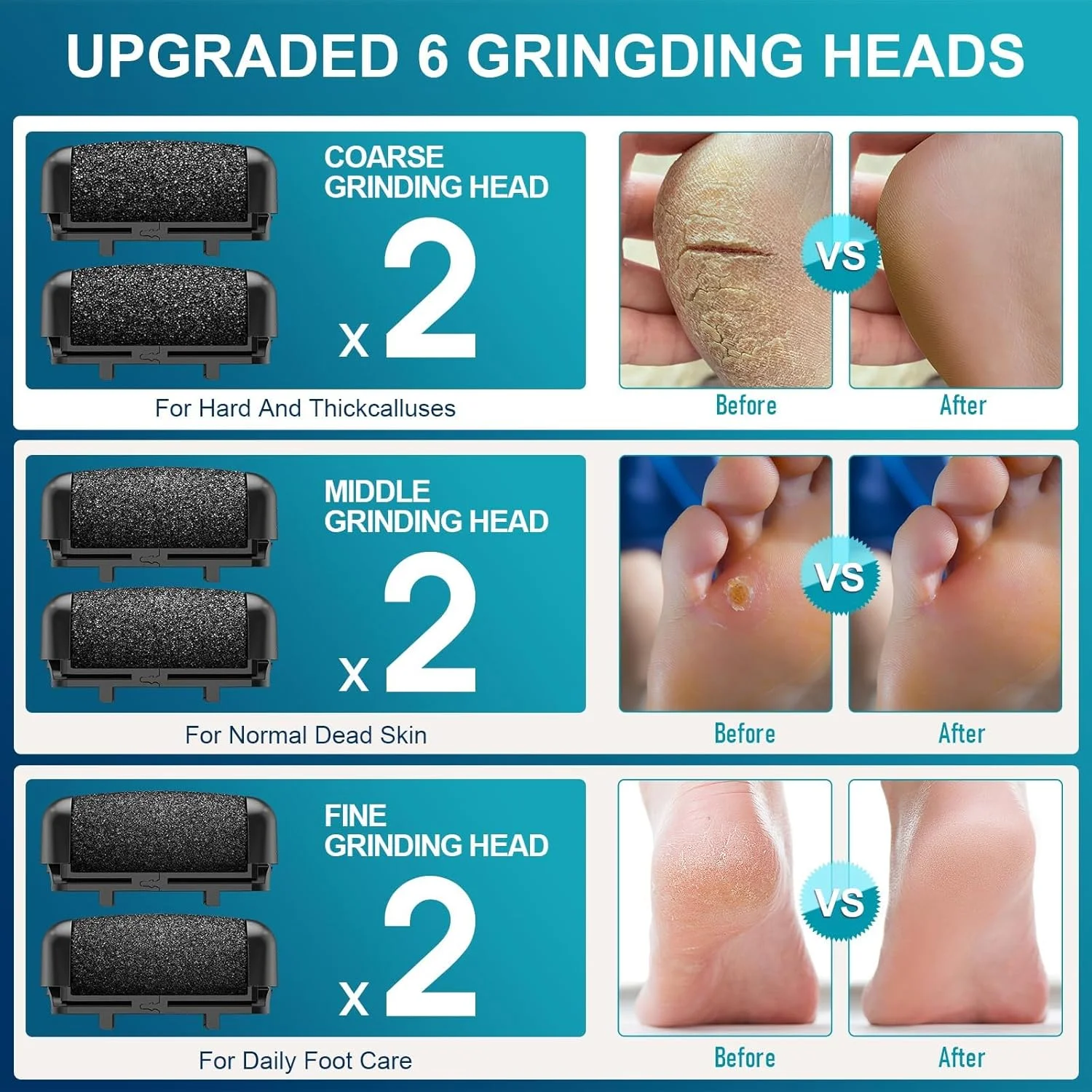 سوهان برقی پای Hoxida برای پوست سخت با 6 غلتک تعویضی، دستگاه ضد آب IPX7 قابل شارژ برای پدیکور پا و از بین بردن پوست مرده (مشکی) سوهان برقی پای Hoxida برای پوست سخت با 6 غلتک تعویضی، دستگاه ضد آب IPX7 قابل شارژ برای پدیکور پا و از بین بردن پوست مرده (مشکی)