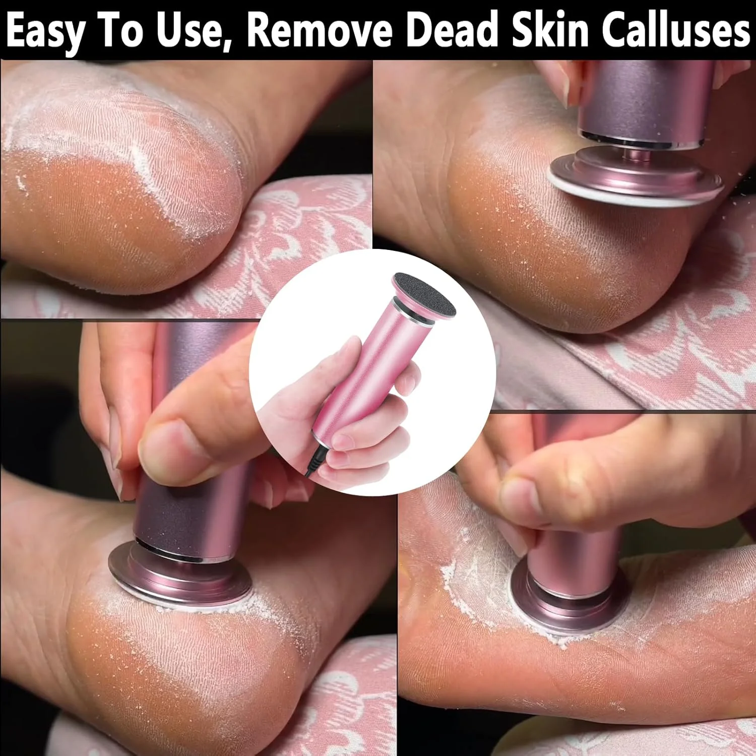 سوهان برقی پدیکور پا I·B·N G (با قابلیت تنظیم سرعت) به همراه 60 عدد دیسک سمباده، ابزار حرفه ای پدیکور برقی، سوهان پا برای از بین بردن پوست های مرده (مدل ارتقا یافته FCR-1 صورتی) سوهان برقی پدیکور پا I·B·N G (با قابلیت تنظیم سرعت) به همراه 60 عدد دیسک سمباده، ابزار حرفه ای پدیکور برقی، سوهان پا برای از بین بردن پوست های مرده (مدل ارتقا یافته FCR-1 صورتی)