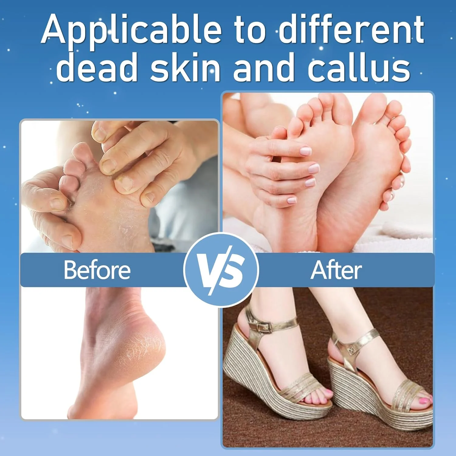 سوهان برقی پا سوهان برقی پا