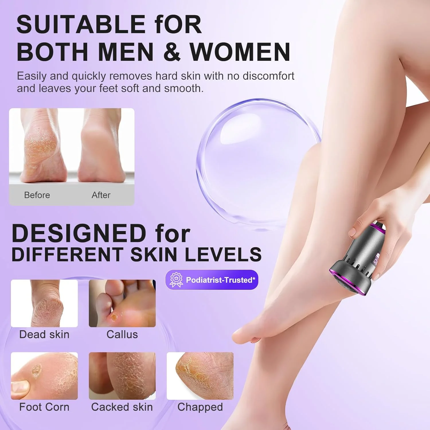 سوهان برقی پدیکور پا آیوفاین، ابزار پدیکور شارژی، دارای سری های استیل ضد زنگ برای پاشنه های خشک (خاکستری بنفش)