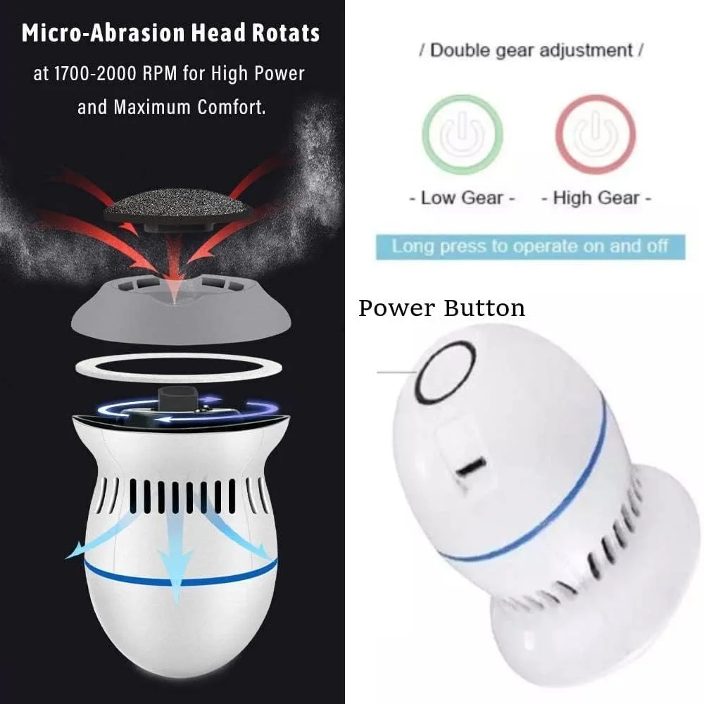 سوهان برقی پا ICALODY، از بین برنده پینه و ترک پا، ابزار پدیکور پا، سوهان پا شارژی، ابزار تمیز کننده پوست ترک خورده، سفید، سبز سوهان برقی پا ICALODY، از بین برنده پینه و ترک پا، ابزار پدیکور پا، سوهان پا شارژی، ابزار تمیز کننده پوست ترک خورده، سفید، سبز