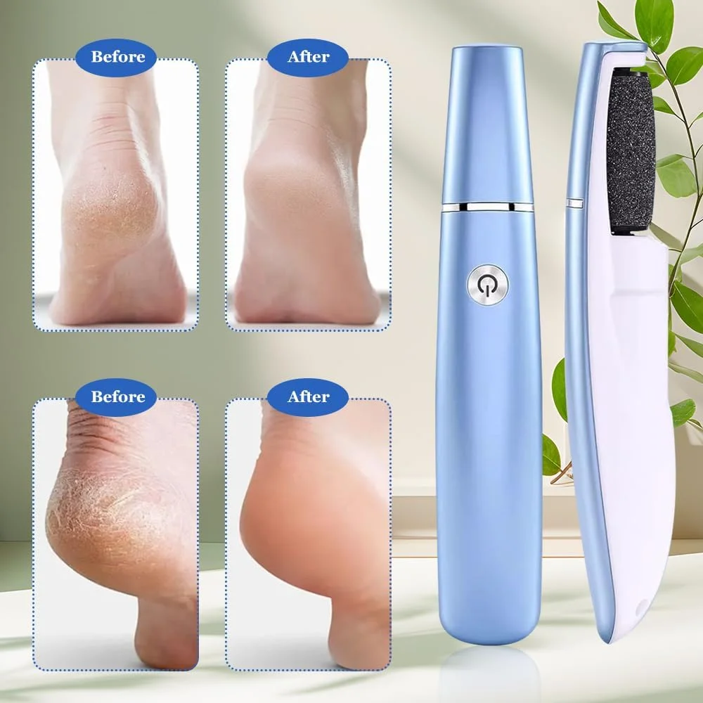 Horuili® Electric Callus Remover for Feet, Electric Pedicure Devices, Foot Callus Remover, Foot Care Tools, for Hard, Dead and Cracked Dry Skin