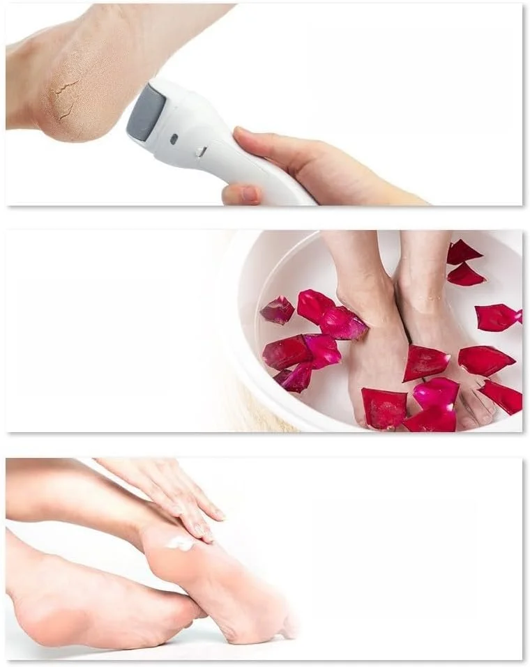 سوهان برقی پدیکور پا HOGOOD، دستگاه قابل حمل صاف کننده پوست پا، ابزار حذف پینه، کیت حرفه ای پدیکور برقی مراقبت از پا با 3 سری غلتکی