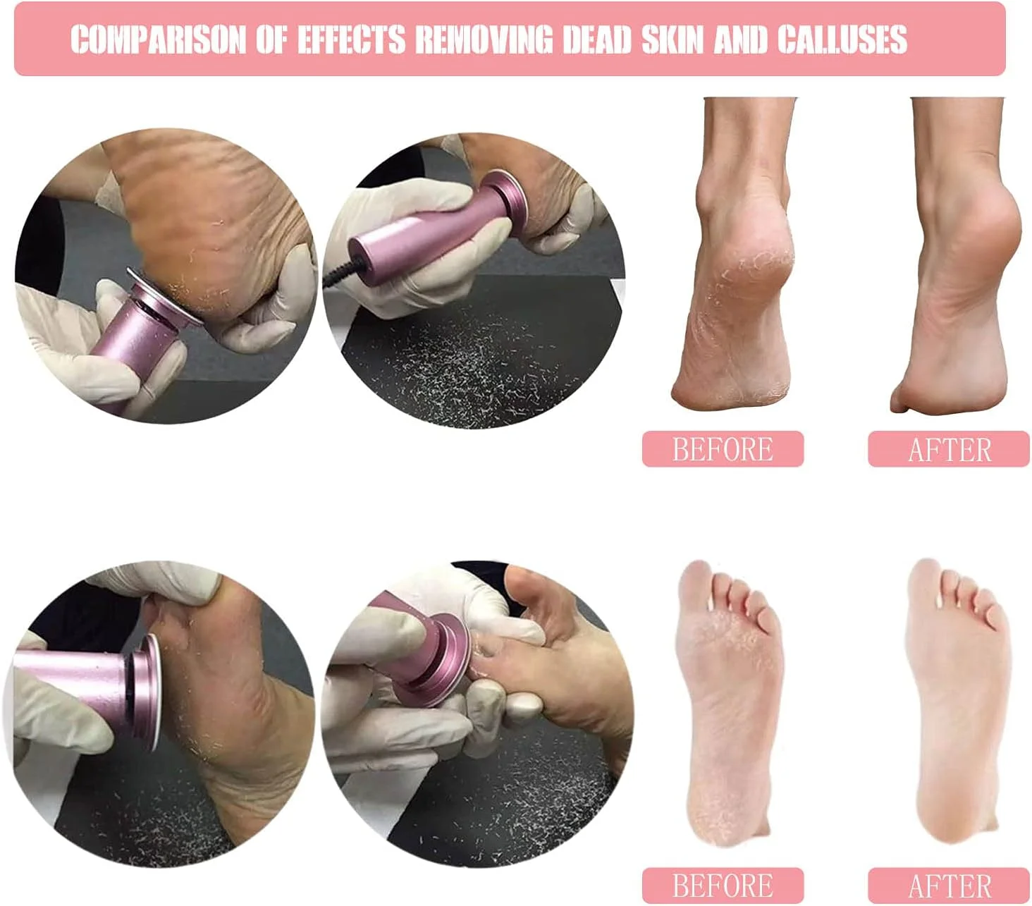 سوهان برقی پا HANNAH.QI، از بین برنده پینه پا، ابزار حرفه ای پدیکور، سرعت قابل تنظیم، 60 عدد دیسک سمباده تعویضی، حذف آسان پوست مرده و پینه (مشکی 60 عدد) سوهان برقی پا HANNAH.QI، از بین برنده پینه پا، ابزار حرفه ای پدیکور، سرعت قابل تنظیم، 60 عدد دیسک سمباده تعویضی، حذف آسان پوست مرده و پینه (مشکی 60 عدد)