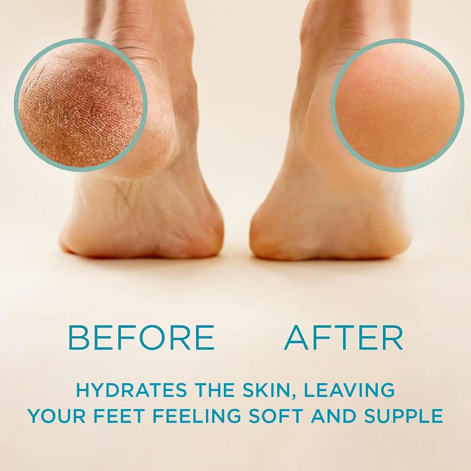 بهترین از بین برنده پینه لی بیوتی پروفشنال، از بین برنده پینه پا، مایع و ژل برای میخچه و پینه پا، عملکرد بهتر از ریش تراش برقی و اسکرابر پا. بهترین از بین برنده پینه لی بیوتی پروفشنال، از بین برنده پینه پا، مایع و ژل برای میخچه و پینه پا، عملکرد بهتر از ریش تراش برقی و اسکرابر پا.