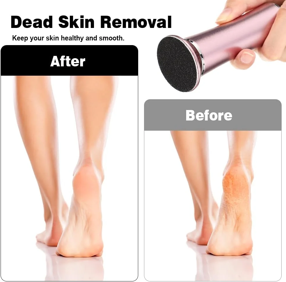 دیسک های سمباده ای جایگزین LIERKISS بسته 120 عددی برای از بین بردن پینه های الکتریکی، دیسک های سمباده ای جایگزین حرفه ای برای سوهان برقی پا، از بین برنده پوست مرده و ترک خورده دیسک های سمباده ای جایگزین LIERKISS بسته 120 عددی برای از بین بردن پینه های الکتریکی، دیسک های سمباده ای جایگزین حرفه ای برای سوهان برقی پا، از بین برنده پوست مرده و ترک خورده