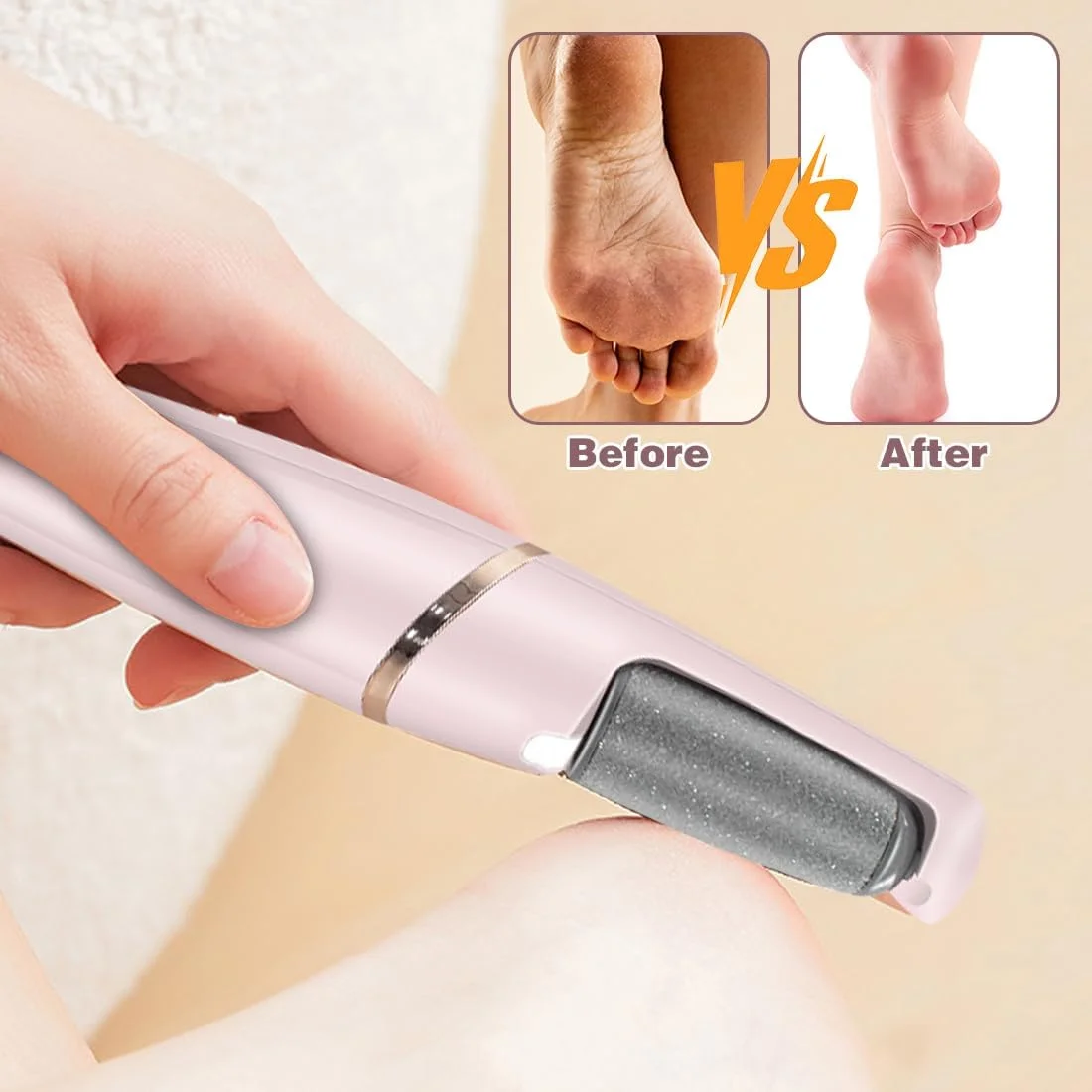 سوهان برقی پینه پا LOMUG، ست پدیکور، مراقبت برقی پا، سوهان برقی پا، ابزار پدیکور برای پوست های مرده، سفت و ترک خورده سوهان برقی پینه پا LOMUG، ست پدیکور، مراقبت برقی پا، سوهان برقی پا، ابزار پدیکور برای پوست های مرده، سفت و ترک خورده
