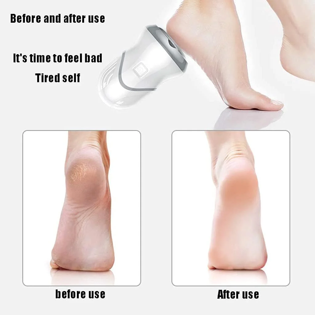 سوهان برقی پا NOOFIE با قابلیت مکش، از بین برنده پوست سفت و پینه پا، ابزار حرفه ای پدیکور قابل حمل برای پوست های خشک و ترک خورده، 1 عدد (2 عدد) سوهان برقی پا NOOFIE با قابلیت مکش، از بین برنده پوست سفت و پینه پا، ابزار حرفه ای پدیکور قابل حمل برای پوست های خشک و ترک خورده، 1 عدد (2 عدد)