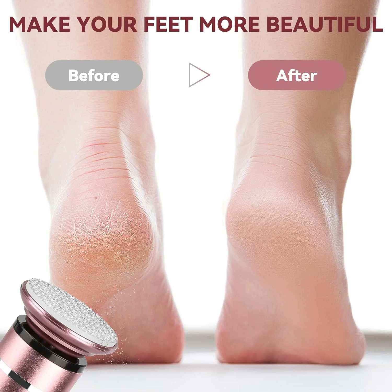 سوهان برقی قابل حمل پا با سر سنگ زنی نانو شیشه ای - از بین برنده پینه شارژی بی سیم برای پاهای صاف، شارژ بی سیم و پدیکور بدون درد سوهان برقی قابل حمل پا با سر سنگ زنی نانو شیشه ای - از بین برنده پینه شارژی بی سیم برای پاهای صاف، شارژ بی سیم و پدیکور بدون درد