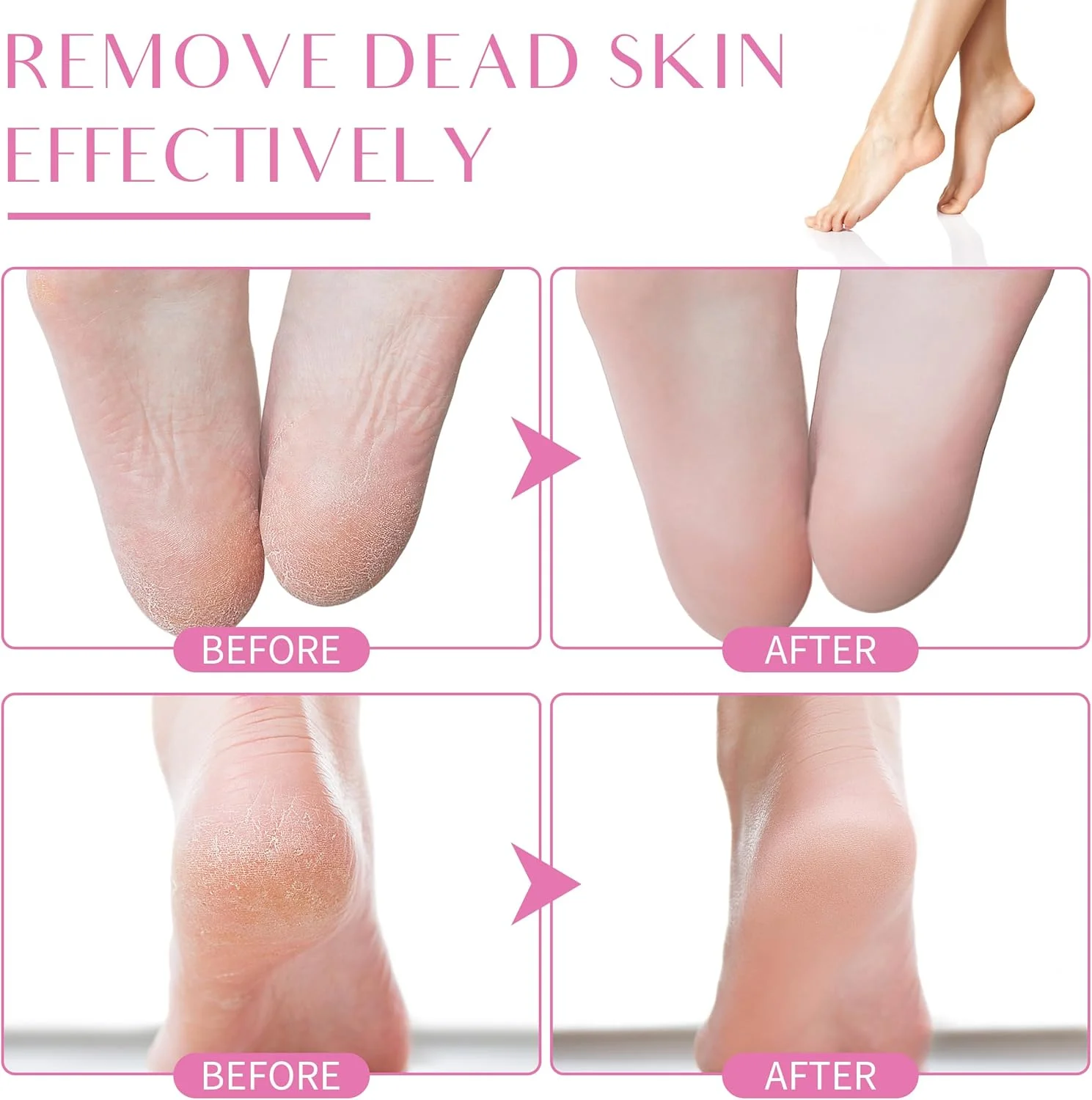 سوهان برقی پا، سوهان برقی پا با 60 عدد کاغذ سنباده تعویضی، سمباده پا خود چسب با چرخش 360 درجه، پوسته آلومینیومی، ناحیه سوهان کاری بزرگ و کنترل کننده سرعت قابل تنظیم سوهان برقی پا، سوهان برقی پا با 60 عدد کاغذ سنباده تعویضی، سمباده پا خود چسب با چرخش 360 درجه، پوسته آلومینیومی، ناحیه سوهان کاری بزرگ و کنترل کننده سرعت قابل تنظیم