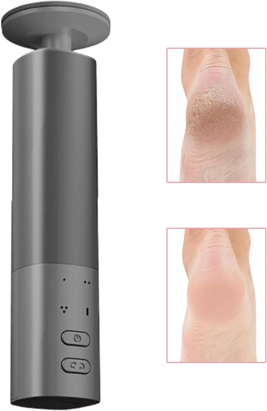 ابزار برقی از بین برنده پینه پا، اسکرابر ارتقا یافته پوست مرده پا، ابزار پدیکور با سرهای قابل تعویض برای بزرگسالان، زنان، مردان ابزار برقی از بین برنده پینه پا، اسکرابر ارتقا یافته پوست مرده پا، ابزار پدیکور با سرهای قابل تعویض برای بزرگسالان، زنان، مردان