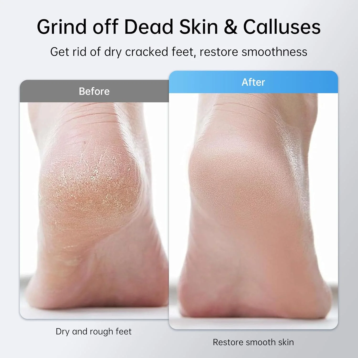 سوهان برقی شارژی پا - سمباده های قابل تعویض، سوهان حرفه ای پا با 6 سرعت قابل تنظیم، سوهان برقی بی سیم پا، ابزار پدیکور برای پوست مرده و پاشنه های ترک خورده سوهان برقی شارژی پا - سمباده های قابل تعویض، سوهان حرفه ای پا با 6 سرعت قابل تنظیم، سوهان برقی بی سیم پا، ابزار پدیکور برای پوست مرده و پاشنه های ترک خورده