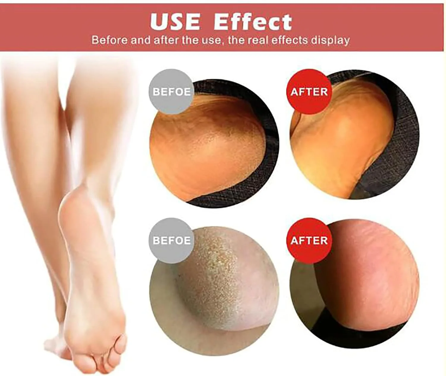 سوهان برقی قابل حمل پا با چراغ LED، حذف کننده پینه USB، 2 غلتک ابزار مراقبت از پوست مرده برای پاهای ترک خورده، سفید (قرمز) سوهان برقی قابل حمل پا با چراغ LED، حذف کننده پینه USB، 2 غلتک ابزار مراقبت از پوست مرده برای پاهای ترک خورده، سفید (قرمز)