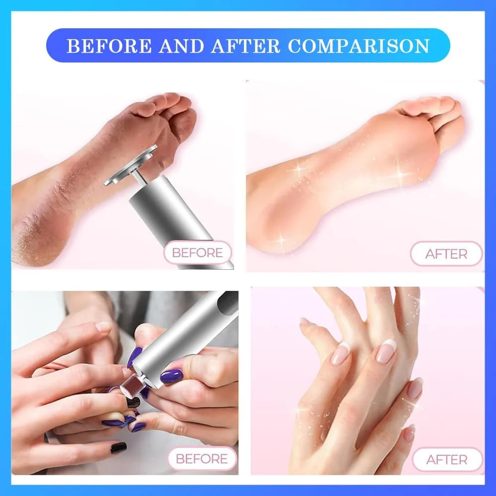 سوهان برقی شارژی پا، سنگ سمباده برقی بی سیم از بین برنده پینه پا به همراه سوهان ناخن 2 در 1، ترک خوردگی و پینه های خشک با دیسک سمباده ای، 6 سرعت قابل تنظیم سوهان برقی شارژی پا، سنگ سمباده برقی بی سیم از بین برنده پینه پا به همراه سوهان ناخن 2 در 1، ترک خوردگی و پینه های خشک با دیسک سمباده ای، 6 سرعت قابل تنظیم